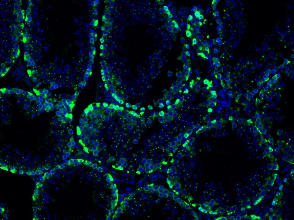 IF Staining using CoraLite®Plus 488-Tyramide Reagent PR30022. 
FFPE-mouse testis tissue was stained with 26718-1-AP (DUSP9 polyclonal antibody) at 1:500 followed by detection with Multi-rAb® Polymer HRP-Goat Anti-Rabbit/Mouse Universal Recombinant Secondary Antibody (H+L) (Cat.NO. RGAU011). CoraLite®Plus 488-Tyramide Reagent (Cat.NO. PR30022) was used for signal development. Cell nucleus (blue) was stained with DAPI.