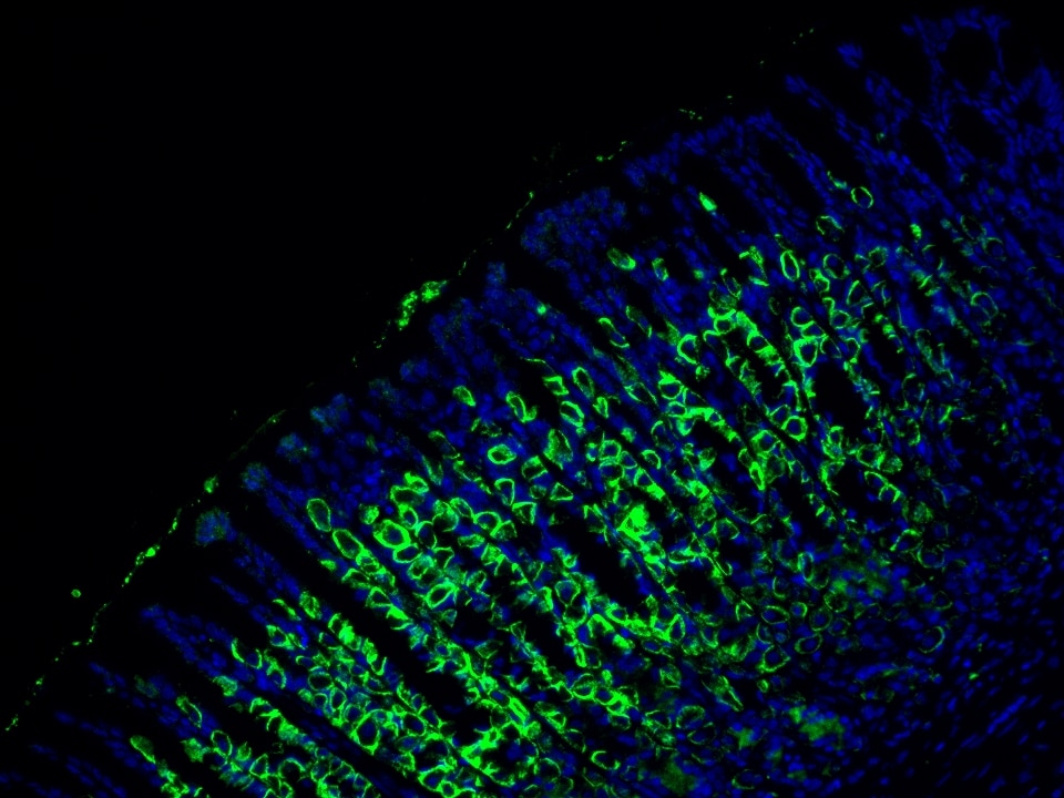 IF Staining using CoraLite®Plus 488-Tyramide Reagent PR30022. 
FFPE-rat stomach tissue was stained with 10182-1-AP (DCTN5 polyclonal antibody) at 1:200 followed by detection with Multi-rAb® Polymer HRP-Goat Anti-Rabbit/Mouse Universal Recombinant Secondary Antibody (H+L) (Cat.NO. RGAU011). CoraLite®Plus 488-Tyramide Reagent (Cat.NO. PR30022) was used for signal development. Cell nucleus (blue) was stained with DAPI.
