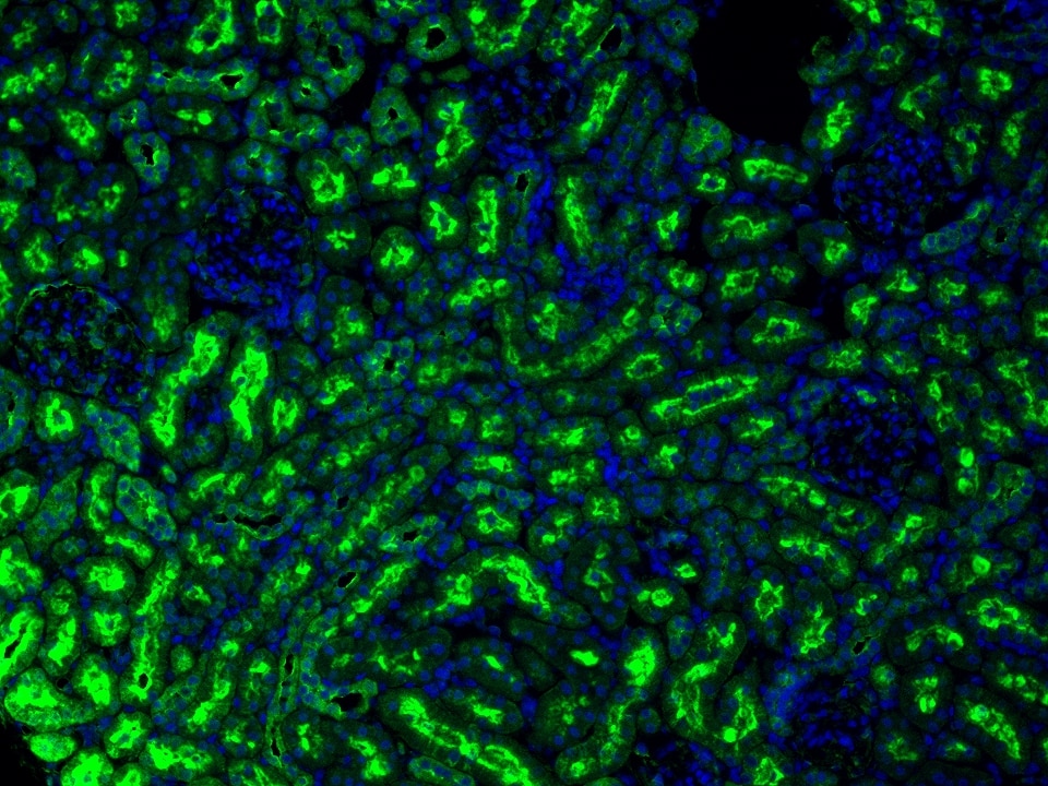IF Staining using CoraLite®Plus 488-Tyramide Reagent PR30022. 
FFPE-rat kidney tissue was stained with 27334-1-AP (IFT74 polyclonal antibody) at 1:500 followed by detection with Multi-rAb® Polymer HRP-Goat Anti-Rabbit/Mouse Universal Recombinant Secondary Antibody (H+L) (Cat.NO. RGAU011). CoraLite®Plus 488-Tyramide Reagent (Cat.NO. PR30022) was used for signal development. Cell nucleus (blue) was stained with DAPI.