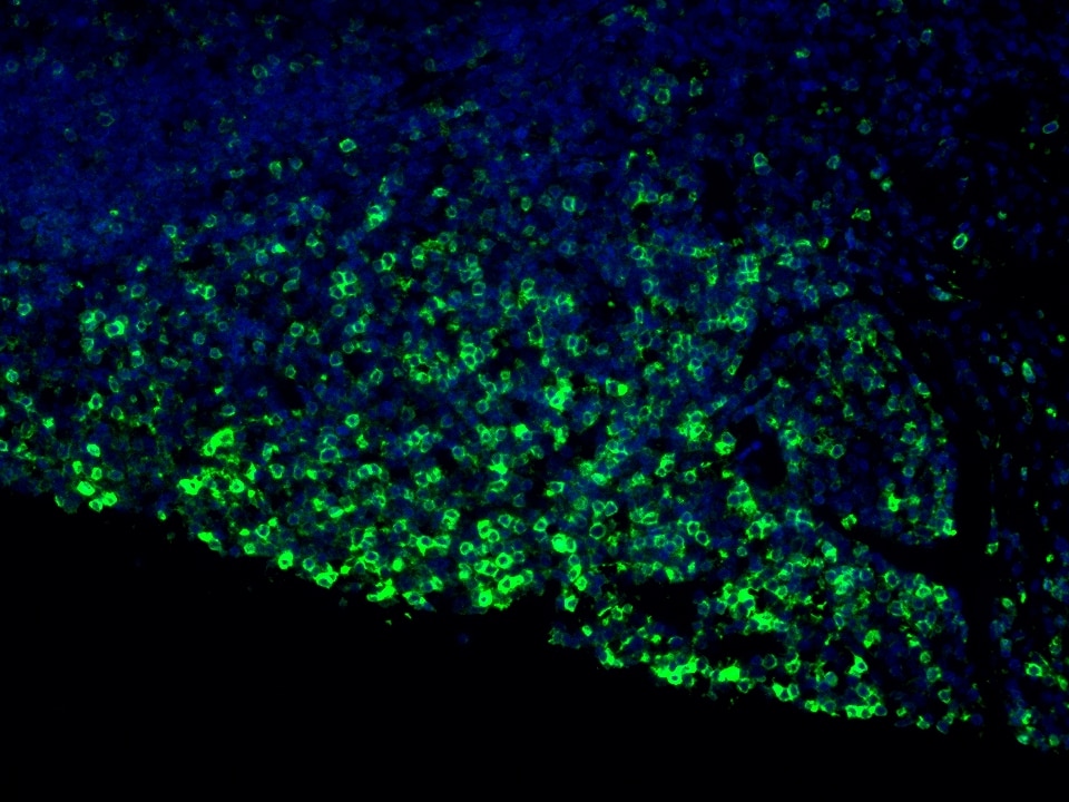 IF Staining using CoraLite®Plus 488-Tyramide Reagent PR30022. 
FFPE-human appendicitis tissue was stained with 65150-1-Ig (CD45RO Monoclonal antibody) at 1:10000 followed by detection with Multi-rAb® Polymer HRP-Goat Anti-Rabbit/Mouse Universal Recombinant Secondary Antibody (H+L) (Cat.NO. RGAU011). CoraLite®Plus 488-Tyramide Reagent (Cat.NO. PR30022) was used for signal development. Cell nucleus (blue) was stained with DAPI.