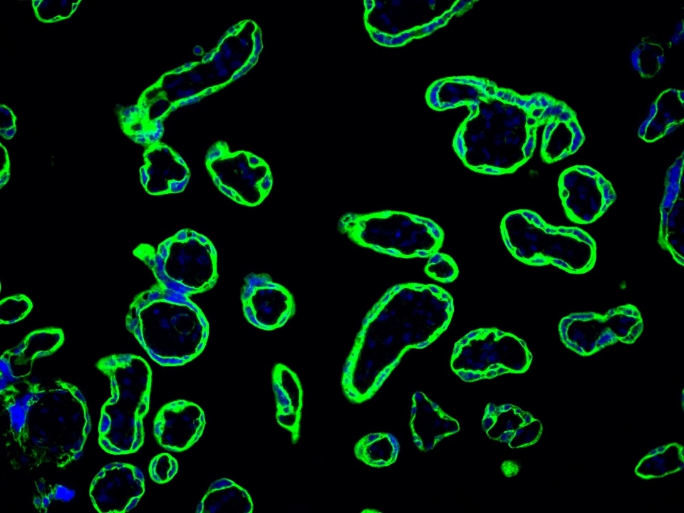 IF Staining using CoraLite®Plus 488-Tyramide Reagent PR30022. 
FFPE-human placenta tissue was stained with 30031-1-AP (SLC43A2 polyclonal antibody) at 1:500 followed by detection with Multi-rAb® Polymer HRP-Goat Anti-Rabbit/Mouse Universal Recombinant Secondary Antibody (H+L) (Cat.NO. RGAU011). CoraLite®Plus 488-Tyramide Reagent (Cat.NO. PR30022) was used for signal development. Cell nucleus (blue) was stained with DAPI.