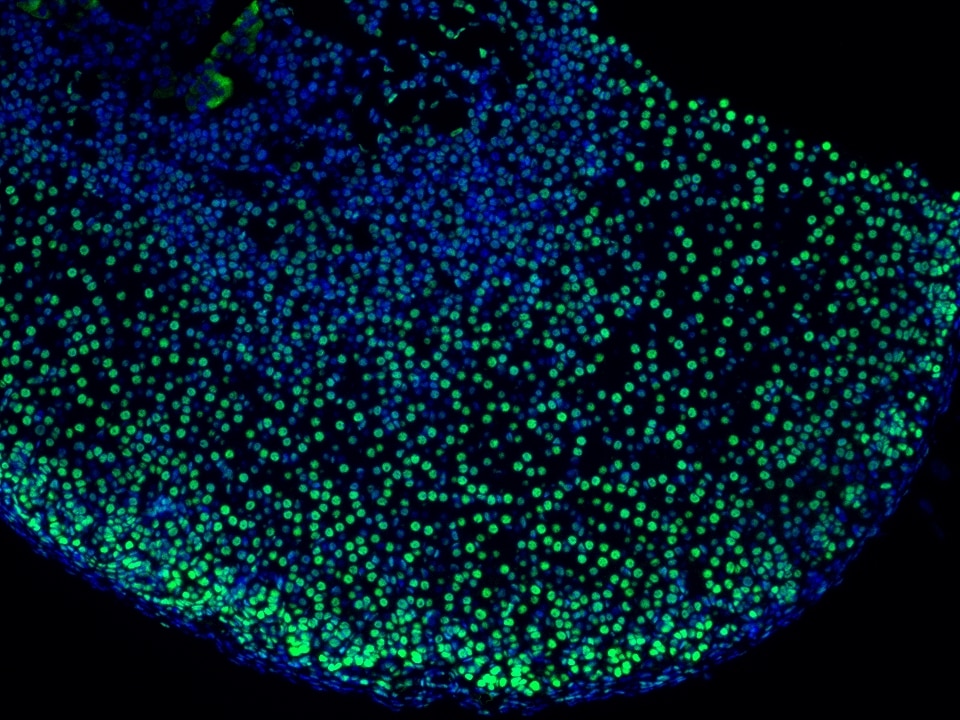 IF Staining using CoraLite®Plus 488-Tyramide Reagent PR30022. 
FFPE-mouse adrenal gland tissue was stained with 82979-6-RR (ARID1B Recombinant antibody) at 1:16000 followed by detection with Multi-rAb® Polymer HRP-Goat Anti-Rabbit/Mouse Universal Recombinant Secondary Antibody (H+L) (Cat.NO. RGAU011). CoraLite®Plus 488-Tyramide Reagent (Cat.NO. PR30022) was used for signal development. Cell nucleus (blue) was stained with DAPI.