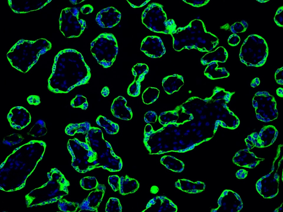 IF Staining using CoraLite®Plus 488-Tyramide Reagent PR30022. 
FFPE-human placenta tissue was stained with 83755-2-RR (RNF139 Recombinant antibody) at 1:2000 followed by detection with Multi-rAb® Polymer HRP-Goat Anti-Rabbit/Mouse Universal Recombinant Secondary Antibody (H+L) (Cat.NO. RGAU011). CoraLite®Plus 488-Tyramide Reagent (Cat.NO. PR30022) was used for signal development. Cell nucleus (blue) was stained with DAPI.