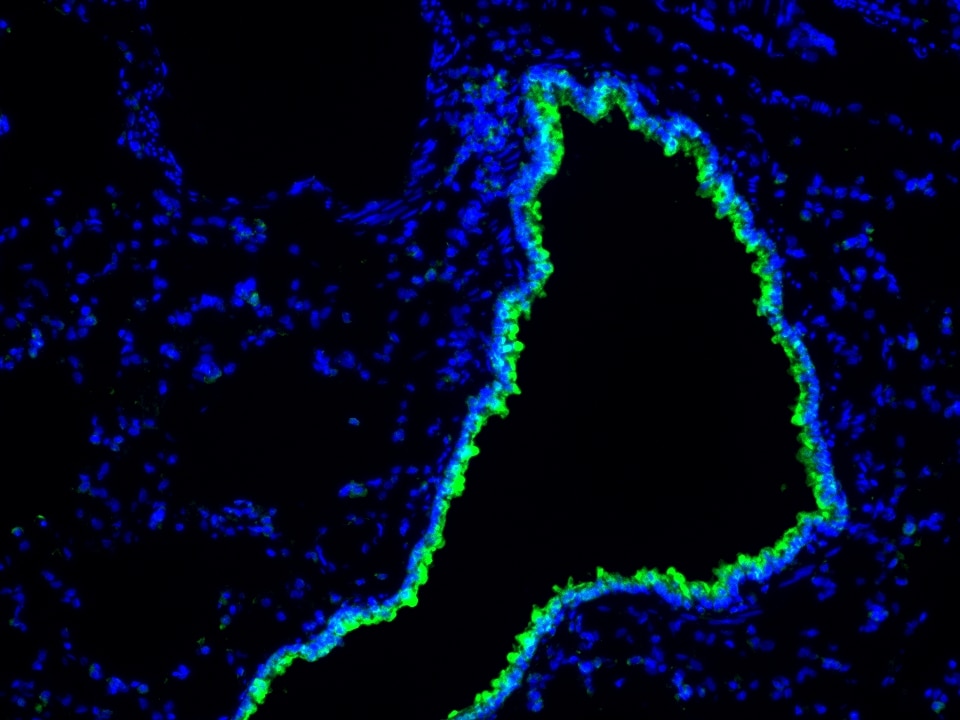 IF Staining using CoraLite®Plus 488-Tyramide Reagent PR30022. 
FFPE-rat lung tissue was stained with 67623-1-Ig (DIS3L2 Monoclonal antibody) at 1:4000 followed by detection with Multi-rAb® Polymer HRP-Goat Anti-Rabbit/Mouse Universal Recombinant Secondary Antibody (H+L) (Cat.NO. RGAU011). CoraLite®Plus 488-Tyramide Reagent (Cat.NO. PR30022) was used for signal development. Cell nucleus (blue) was stained with DAPI.