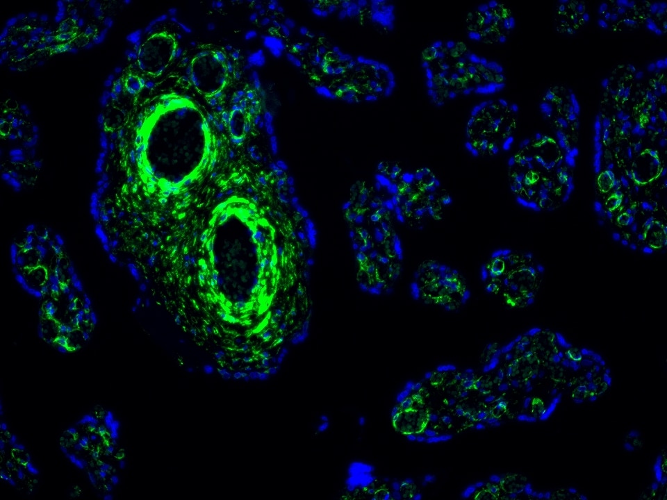 IF Staining using CoraLite®Plus 488-Tyramide Reagent PR30022. 
FFPE-human placenta tissue was stained with 67882-1-Ig (LPCAT3 Monoclonal antibody) at 1:1000 followed by detection with Multi-rAb® Polymer HRP-Goat Anti-Rabbit/Mouse Universal Recombinant Secondary Antibody (H+L) (Cat.NO. RGAU011). CoraLite®Plus 488-Tyramide Reagent (Cat.NO. PR30022) was used for signal development. Cell nucleus (blue) was stained with DAPI.
