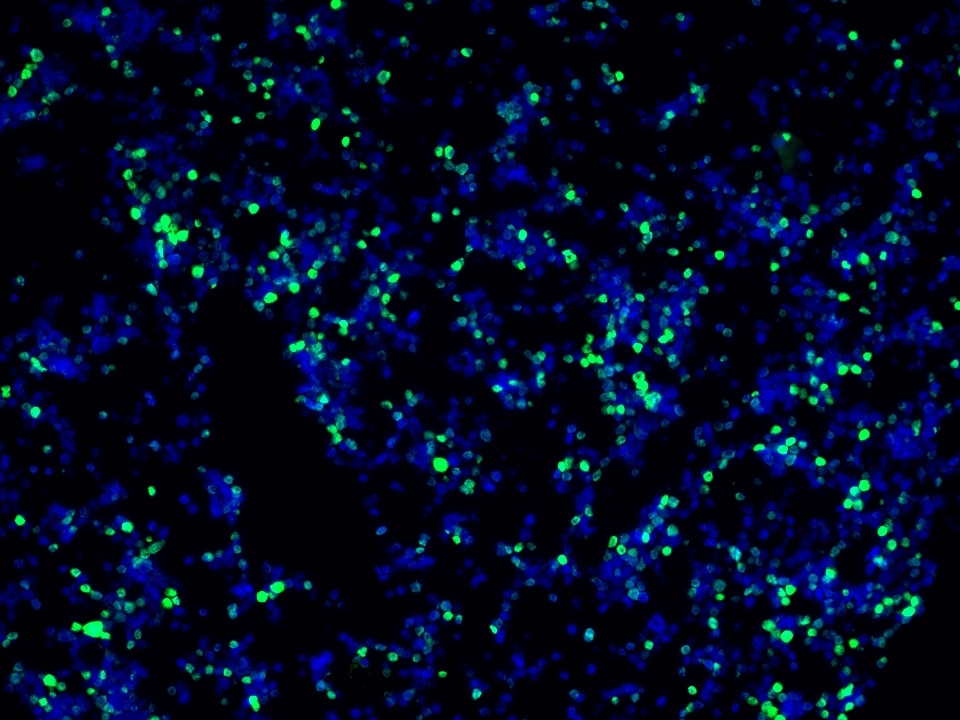 IF Staining using CoraLite®Plus 488-Tyramide Reagent PR30022. 
FFPE-MJ cells was stained with 68803-2-Ig (FOXP3 Monoclonal antibody) at 1:2000 followed by detection with Multi-rAb® Polymer HRP-Goat Anti-Rabbit/Mouse Universal Recombinant Secondary Antibody (H+L) (Cat.NO. RGAU011). CoraLite®Plus 488-Tyramide Reagent (Cat.NO. PR30022) was used for signal development. Cell nucleus (blue) was stained with DAPI.