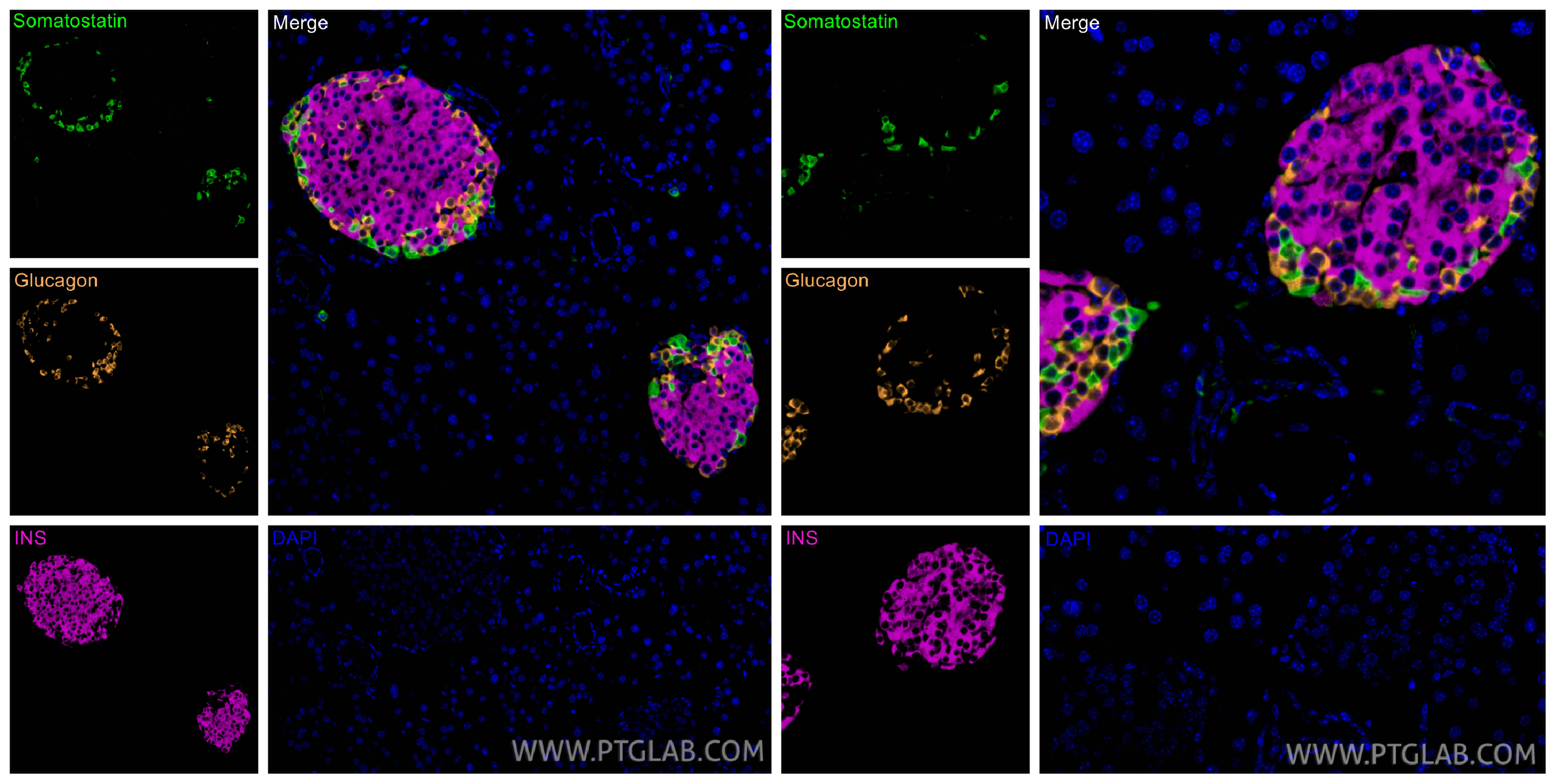 Immunofluorescent analysis of (4% PFA) fixed paraffin-embedded mouse pancreas tissue using Somatostatin antibody 84351-1-RR at dilution of 1:200 with CoraLite®Plus 488-Tyramide reagent(green), INS antibody 15848-1-AP at dilution of 1:200 with CoraLite®Plus 647-Tyramide reagent(magenta), Glucagon antibody 15954-1-AP with CoraLite®Plus 555-Tyramide reagent(orange). Heat mediated antigen retrieval with Tris-EDTA buffer (pH 9.0). Immunofluorescent analysis of (4% PFA) fixed paraffin-embedded mouse pancreas tissue using Somatostatin antibody 84351-1-RR at dilution of 1:200 with CoraLite®Plus 488-Tyramide reagent(green), INS antibody 15848-1-AP at dilution of 1:200 with CoraLite®Plus 647-Tyramide reagent(magenta), Glucagon antibody 15954-1-AP with CoraLite®Plus 555-Tyramide reagent(orange). Heat mediated antigen retrieval with Tris-EDTA buffer (pH 9.0).