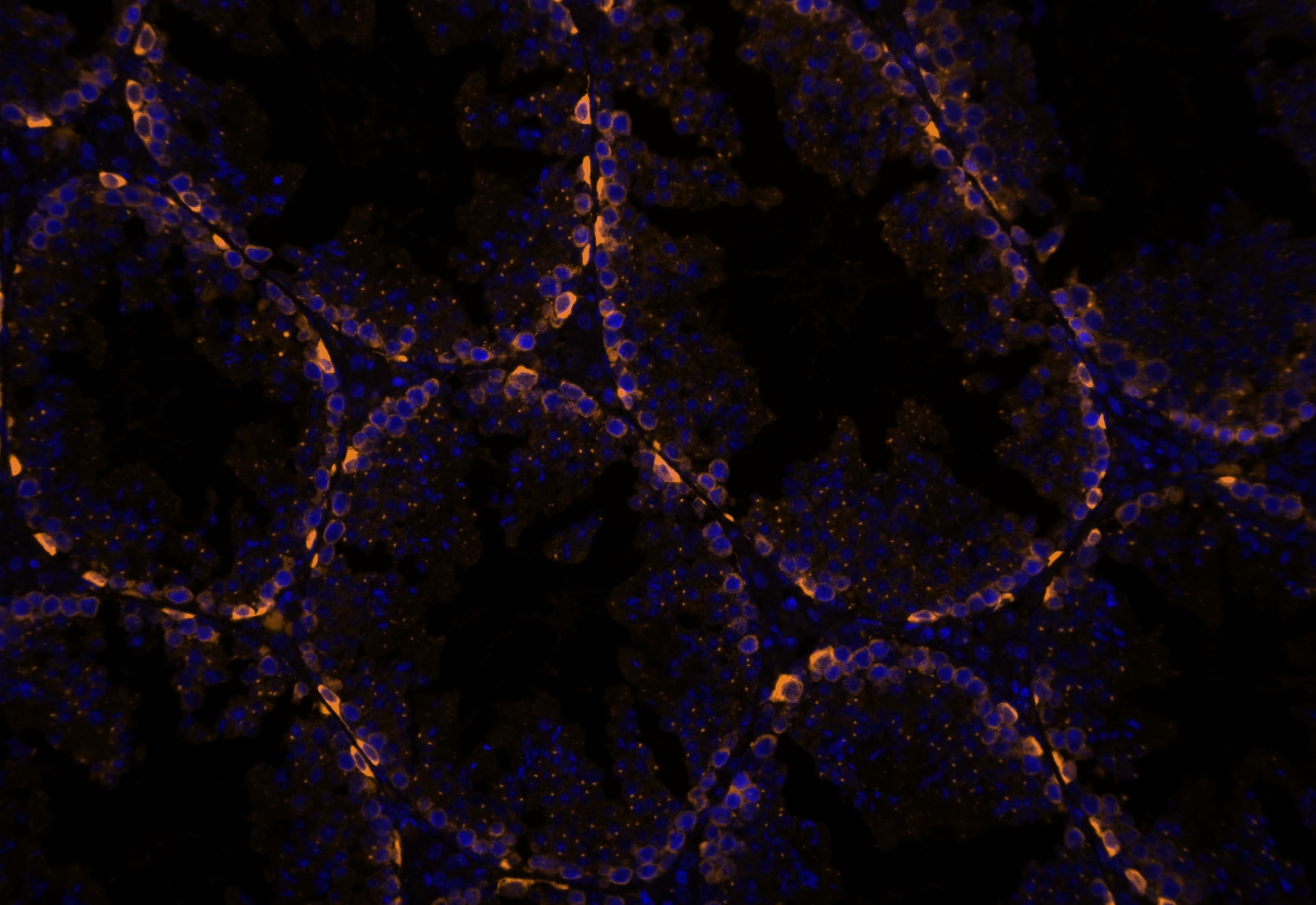 IF Staining using CoraLite®Plus 555-Tyramide Reagent PR30023. 
FFPE-mouse testis tissue was stained with 26718-1-AP (DUSP9 polyclonal antibody) at 1:500 followed by detection with Multi-rAb® Polymer HRP-Goat Anti-Rabbit/Mouse Universal Recombinant Secondary Antibody (H+L) (Cat.NO. RGAU011). CoraLite®Plus 555-Tyramide Reagent (Cat.NO. PR30023) was used for signal development. Cell nucleus (blue) was stained with DAPI.