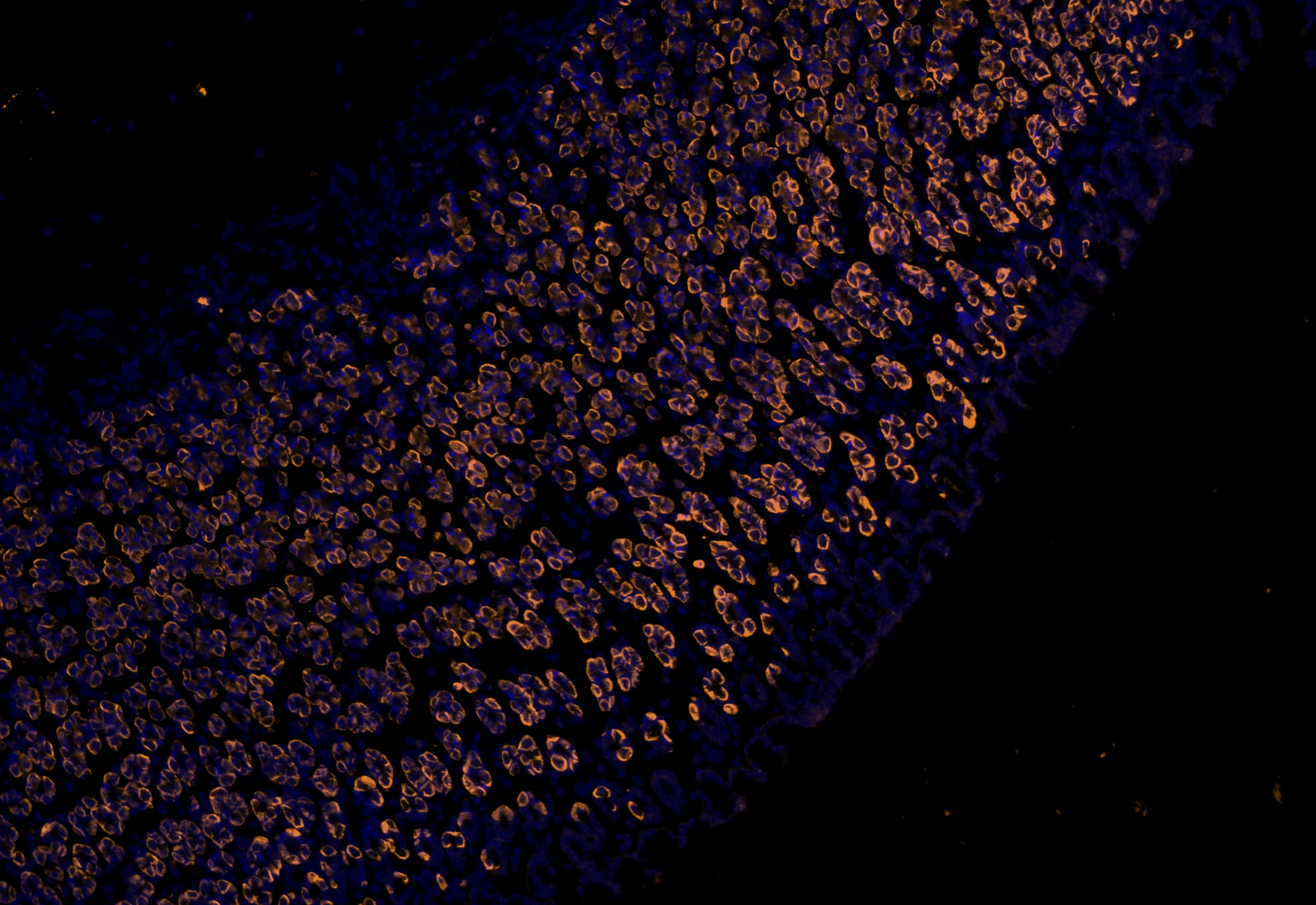 IF Staining using CoraLite®Plus 555-Tyramide Reagent PR30023. 
FFPE-rat stomach tissue was stained with 10182-1-AP (DCTN5 polyclonal antibody) at 1:200 followed by detection with Multi-rAb® Polymer HRP-Goat Anti-Rabbit/Mouse Universal Recombinant Secondary Antibody (H+L) (Cat.NO. RGAU011). CoraLite®Plus 555-Tyramide Reagent (Cat.NO. PR30023) was used for signal development. Cell nucleus (blue) was stained with DAPI.