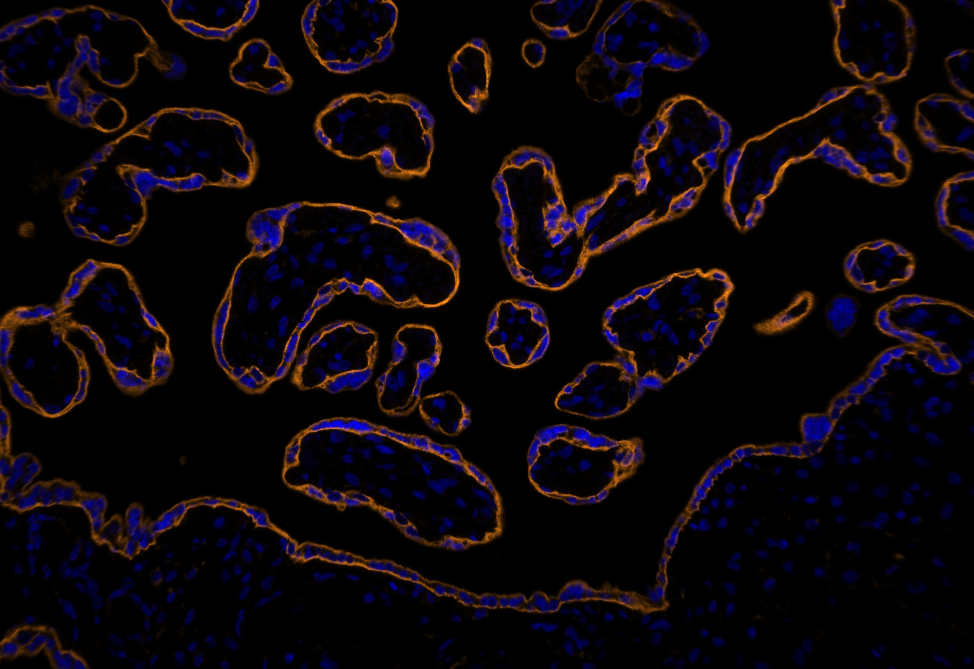 IF Staining using CoraLite®Plus 555-Tyramide Reagent PR30023. 
FFPE-human placenta tissue was stained with 30031-1-AP (SLC43A2 polyclonal antibody) at 1:500 followed by detection with Multi-rAb® Polymer HRP-Goat Anti-Rabbit/Mouse Universal Recombinant Secondary Antibody (H+L) (Cat.NO. RGAU011). CoraLite®Plus 555-Tyramide Reagent (Cat.NO. PR30023) was used for signal development. Cell nucleus (blue) was stained with DAPI.