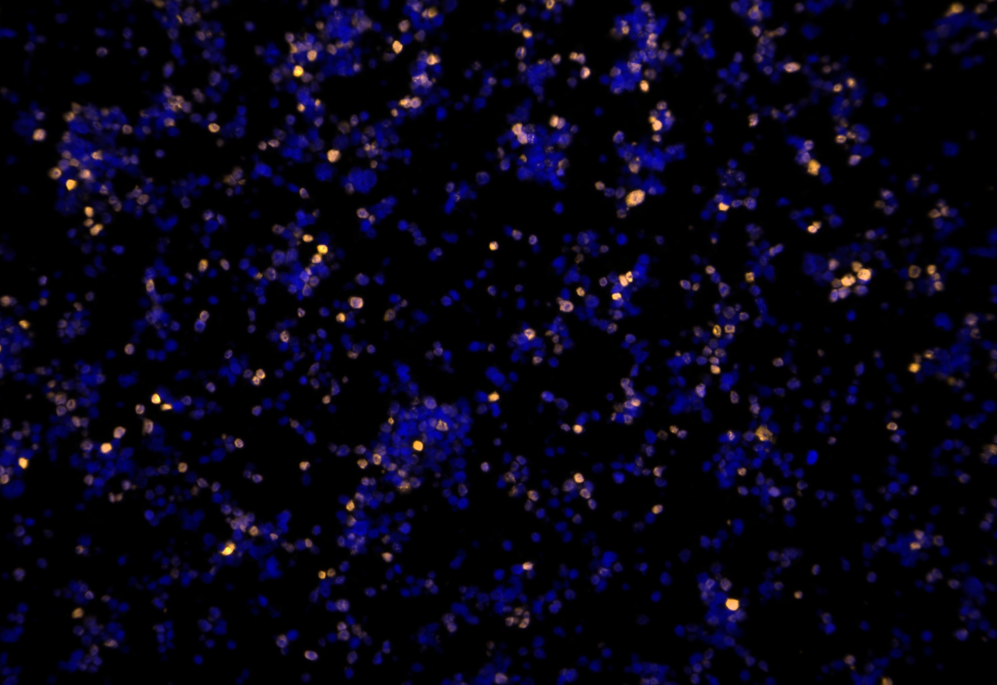 IF Staining using CoraLite®Plus 555-Tyramide Reagent PR30023. 
FFPE-MJ cells was stained with 68803-2-Ig (FOXP3 Monoclonal antibody) at 1:2000 followed by detection with Multi-rAb® Polymer HRP-Goat Anti-Rabbit/Mouse Universal Recombinant Secondary Antibody (H+L) (Cat.NO. RGAU011). CoraLite®Plus 555-Tyramide Reagent (Cat.NO. PR30023) was used for signal development. Cell nucleus (blue) was stained with DAPI.   