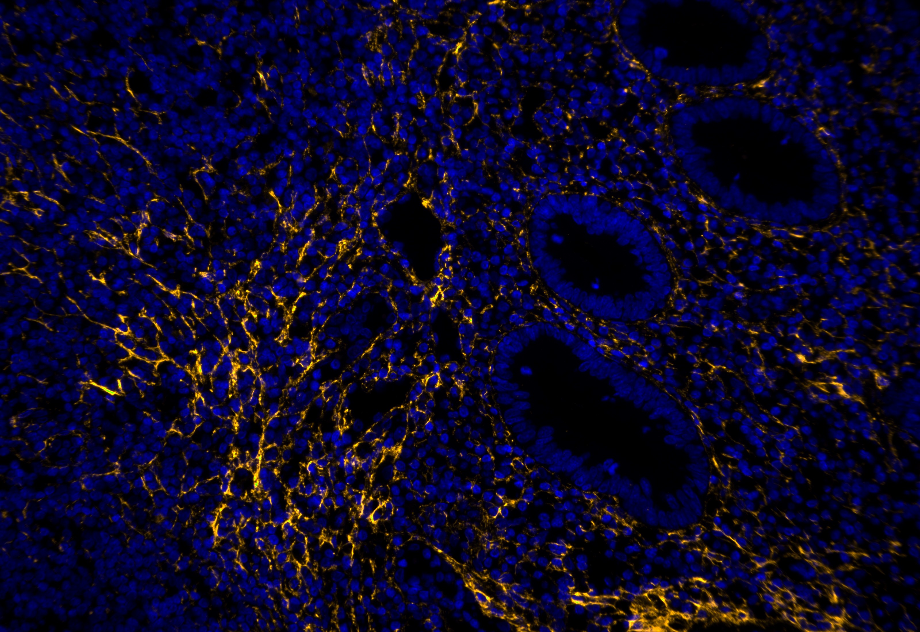 IF Staining using CoraLite®Plus 555-Tyramide Reagent PR30023. 
FFPE-human appendicitis tissue was stained with 67288-1-Ig (Collagen Type I Monoclonal antibody) at 1:4000 followed by detection with Multi-rAb® Polymer HRP-Goat Anti-Rabbit/Mouse Universal Recombinant Secondary Antibody (H+L) (Cat.NO. RGAU011). CoraLite®Plus 555-Tyramide Reagent (Cat.NO. PR30023) was used for signal development. Cell nucleus (blue) was stained with DAPI. 