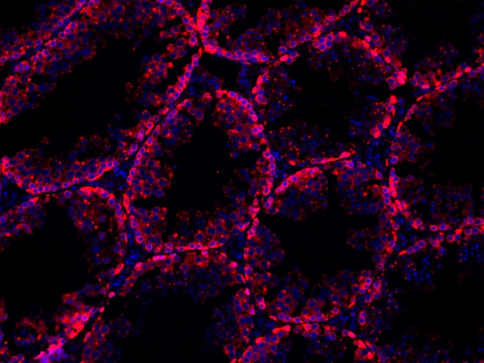 IF Staining using CoraLite®Plus 594-Tyramide Reagent PR30024. 
FFPE-mouse testis tissue was stained with 26718-1-AP (DUSP9 polyclonal antibody) at 1:500 followed by detection with Multi-rAb® Polymer HRP-Goat Anti-Rabbit/Mouse Universal Recombinant Secondary Antibody (H+L) (Cat.NO. RGAU011). CoraLite®Plus 594-Tyramide Reagent (Cat.NO. PR30024) was used for signal development. Cell nucleus (blue) was stained with DAPI.