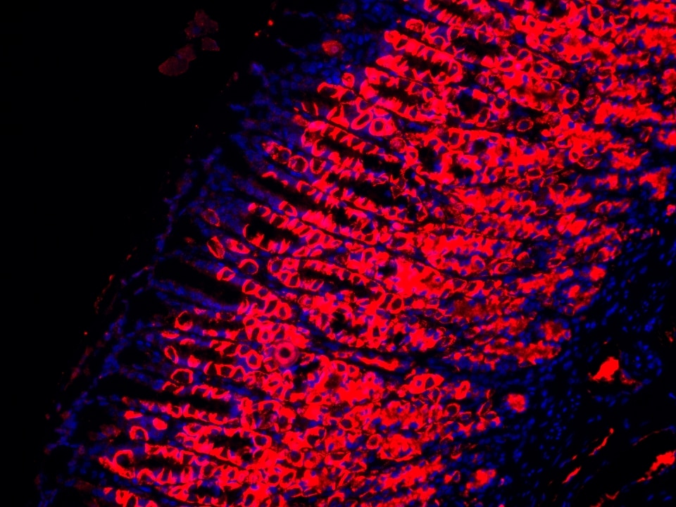 IF Staining using CoraLite®Plus 594-Tyramide Reagent PR30024. 
FFPE-rat stomach tissue was stained with 10182-1-AP (DCTN5 polyclonal antibody) at 1:200 followed by detection with Multi-rAb® Polymer HRP-Goat Anti-Rabbit/Mouse Universal Recombinant Secondary Antibody (H+L) (Cat.NO. RGAU011). CoraLite®Plus 594-Tyramide Reagent (Cat.NO. PR30024) was used for signal development. Cell nucleus (blue) was stained with DAPI.