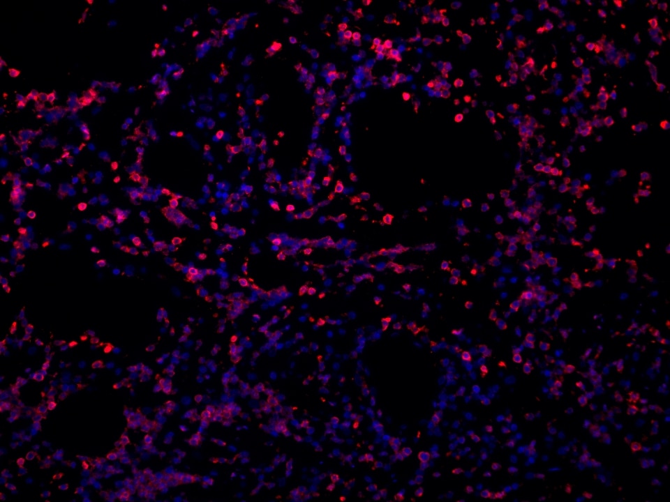 IF Staining using CoraLite®Plus 594-Tyramide Reagent PR30024. 
FFPE-human appendicitis tissue was stained with 65150-1-Ig (CD45RO Monoclonal antibody) at 1:10000 followed by detection with Multi-rAb® Polymer HRP-Goat Anti-Rabbit/Mouse Universal Recombinant Secondary Antibody (H+L) (Cat.NO. RGAU011). CoraLite®Plus 594-Tyramide Reagent (Cat.NO. PR30024) was used for signal development. Cell nucleus (blue) was stained with DAPI.
