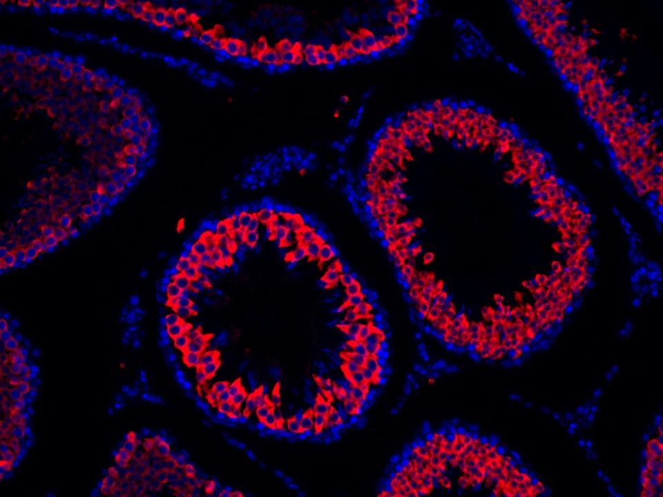 IF Staining using CoraLite®Plus 594-Tyramide Reagent PR30024. 
FFPE-rat testis tissue was stained with 13720-1-AP (BOULE polyclonal antibody) at 1:2000 followed by detection with Multi-rAb® Polymer HRP-Goat Anti-Rabbit/Mouse Universal Recombinant Secondary Antibody (H+L) (Cat.NO. RGAU011). CoraLite®Plus 594-Tyramide Reagent (Cat.NO. PR30024) was used for signal development. Cell nucleus (blue) was stained with DAPI.