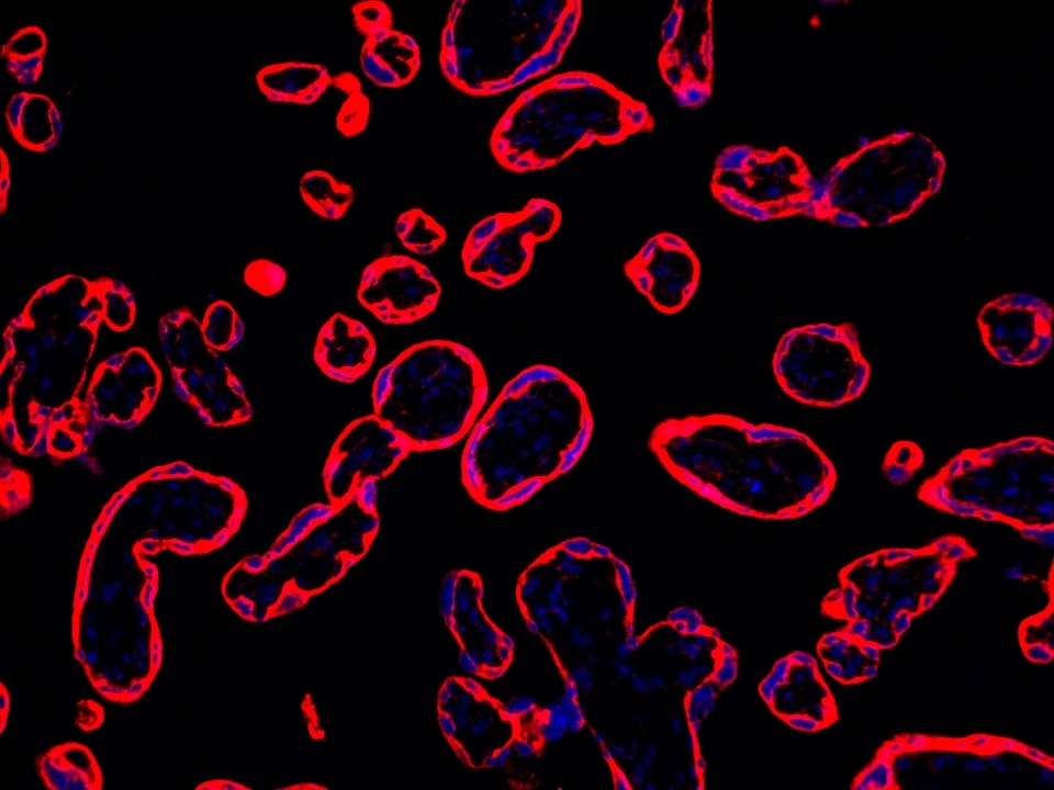 IF Staining using CoraLite®Plus 594-Tyramide Reagent PR30024. 
FFPE-human placenta tissue was stained with 30031-1-AP (SLC43A2 polyclonal antibody) at 1:500 followed by detection with Multi-rAb® Polymer HRP-Goat Anti-Rabbit/Mouse Universal Recombinant Secondary Antibody (H+L) (Cat.NO. RGAU011). CoraLite®Plus 594-Tyramide Reagent (Cat.NO. PR30024) was used for signal development. Cell nucleus (blue) was stained with DAPI.