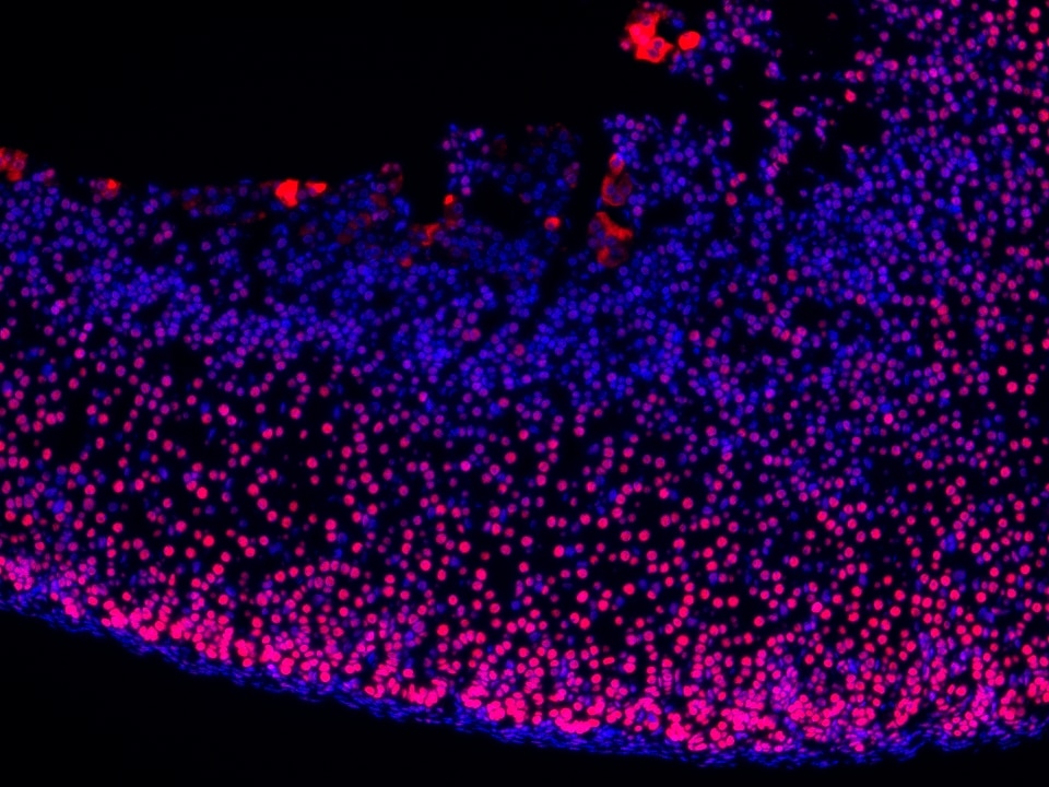 IF Staining using CoraLite®Plus 594-Tyramide Reagent PR30024. 
FFPE-mouse adrenal gland tissue was stained with 82979-6-RR (ARID1B Recombinant antibody) at 1:16000 followed by detection with Multi-rAb® Polymer HRP-Goat Anti-Rabbit/Mouse Universal Recombinant Secondary Antibody (H+L) (Cat.NO. RGAU011). CoraLite®Plus 594-Tyramide Reagent (Cat.NO. PR30024) was used for signal development. Cell nucleus (blue) was stained with DAPI.