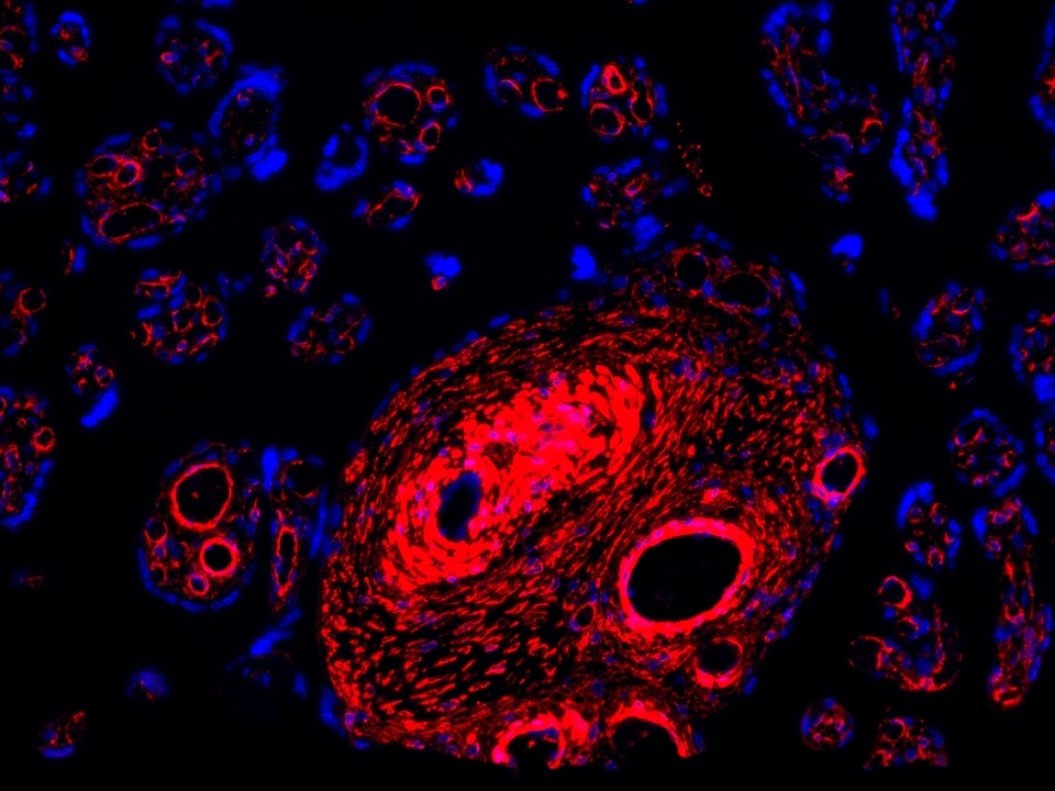 IF Staining using CoraLite®Plus 594-Tyramide Reagent PR30024. 
FFPE-human placenta tissue was stained with 67882-1-Ig (LPCAT3 Monoclonal antibody) at 1:1000 followed by detection with Multi-rAb® Polymer HRP-Goat Anti-Rabbit/Mouse Universal Recombinant Secondary Antibody (H+L) (Cat.NO. RGAU011). CoraLite®Plus 594-Tyramide Reagent (Cat.NO. PR30024) was used for signal development. Cell nucleus (blue) was stained with DAPI.
