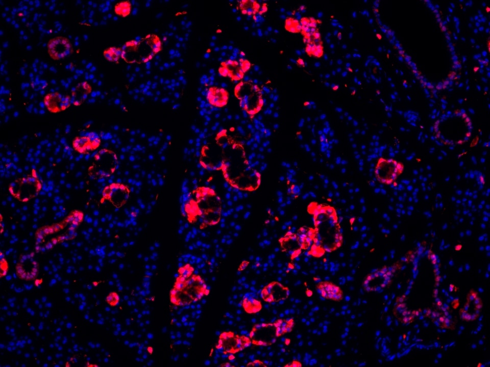 IF Staining using CoraLite®Plus 594-Tyramide Reagent PR30024. 
FFPE-rat salivary gland tissue was stained with 83356-5-RR (DUSP6 Recombinant antibody) at 1:1000 followed by detection with Multi-rAb® Polymer HRP-Goat Anti-Rabbit/Mouse Universal Recombinant Secondary Antibody (H+L) (Cat.NO. RGAU011). CoraLite®Plus 594-Tyramide Reagent (Cat.NO. PR30024) was used for signal development. Cell nucleus (blue) was stained with DAPI.