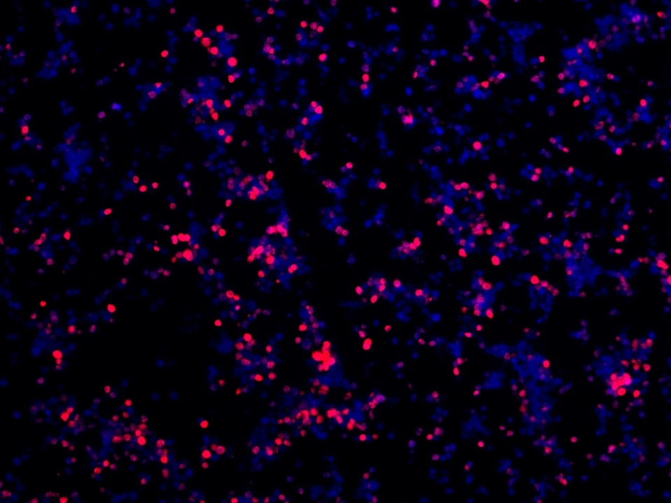 IF Staining using CoraLite®Plus 594-Tyramide Reagent PR30024. 
FFPE-MJ cells was stained with 68803-2-Ig (FOXP3 Monoclonal antibody) at 1:2000 followed by detection with Multi-rAb® Polymer HRP-Goat Anti-Rabbit/Mouse Universal Recombinant Secondary Antibody (H+L) (Cat.NO. RGAU011). CoraLite®Plus 594-Tyramide Reagent (Cat.NO. PR30024) was used for signal development. Cell nucleus (blue) was stained with DAPI. 