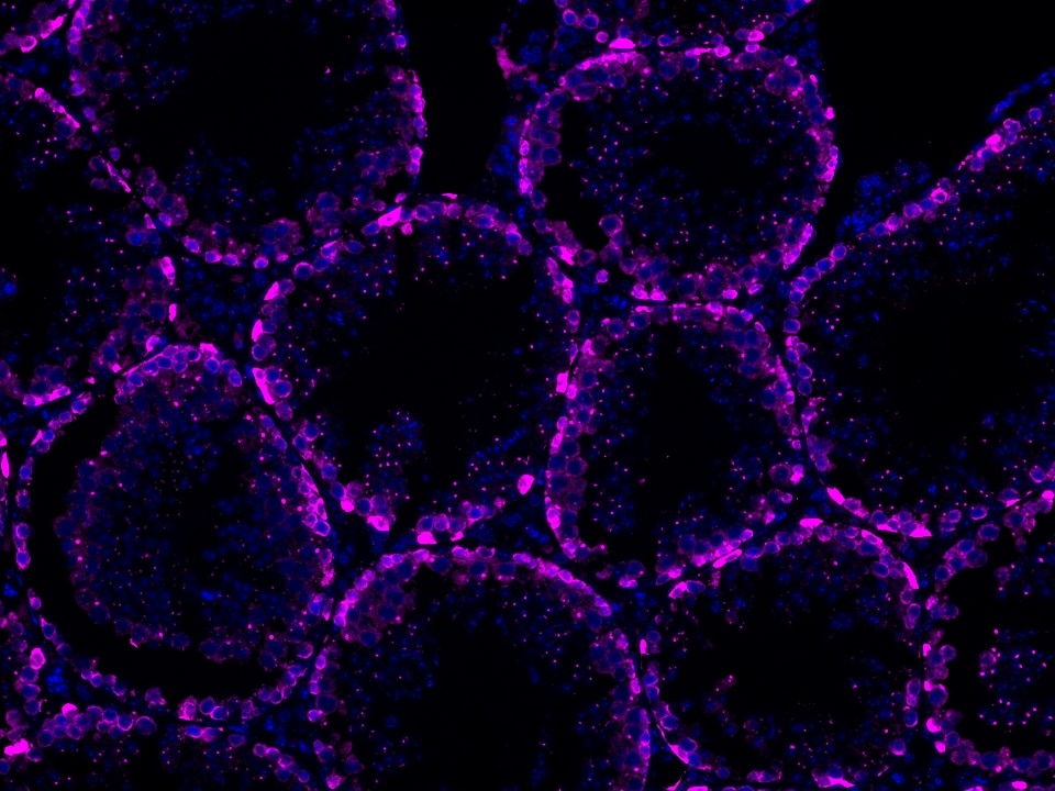 IF Staining using CoraLite®Plus 647-Tyramide Reagent PR30025. 
FFPE-mouse testis tissue was stained with 26718-1-AP (DUSP9 polyclonal antibody) at 1:500 followed by detection of Multi-rAb® Polymer HRP-Goat Anti-Rabbit/Mouse Universal Recombinant Secondary Antibody (H+L) (Cat.NO. RGAU011). CoraLite®Plus 647-Tyramide Reagent (Cat.NO. PR30025) was used for signal development. Cell nucleus (blue) was stained with DAPI.