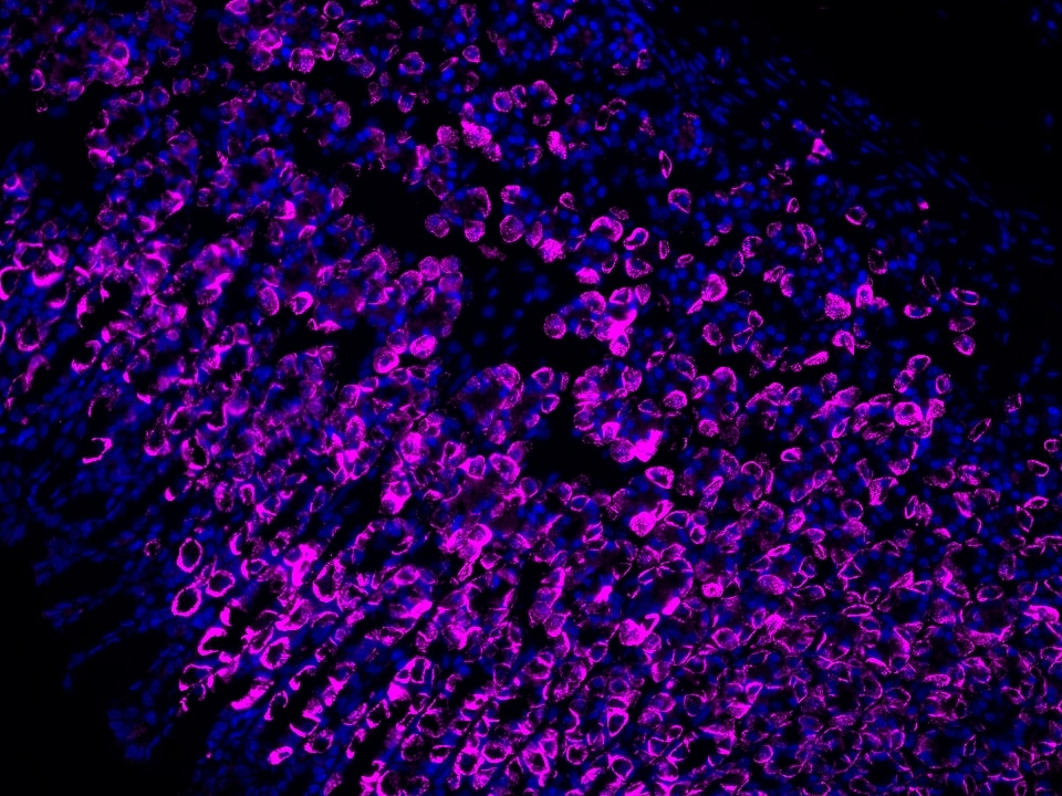 IF Staining using CoraLite®Plus 647-Tyramide Reagent PR30025. 
FFPE-rat stomach tissue was stained with 10182-1-AP (DCTN5 polyclonal antibody) at 1:200 followed by detection of Multi-rAb® Polymer HRP-Goat Anti-Rabbit/Mouse Universal Recombinant Secondary Antibody (H+L) (Cat.NO. RGAU011). CoraLite®Plus 647-Tyramide Reagent (Cat.NO. PR30025) was used for signal development. Cell nucleus (blue) was stained with DAPI.