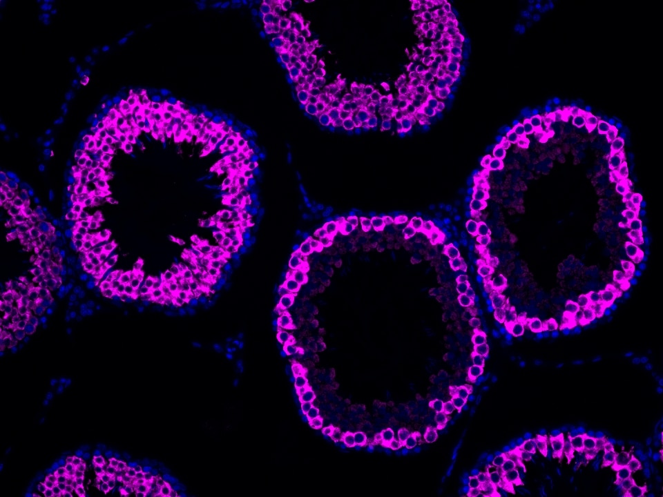 IF Staining using CoraLite®Plus 647-Tyramide Reagent PR30025. 
FFPE-rat testis tissue was stained with 13720-1-AP (BOULE polyclonal antibody) at 1:2000 followed by detection of Multi-rAb® Polymer HRP-Goat Anti-Rabbit/Mouse Universal Recombinant Secondary Antibody (H+L) (Cat.NO. RGAU011). CoraLite®Plus 647-Tyramide Reagent (Cat.NO. PR30025) was used for signal development. Cell nucleus (blue) was stained with DAPI.