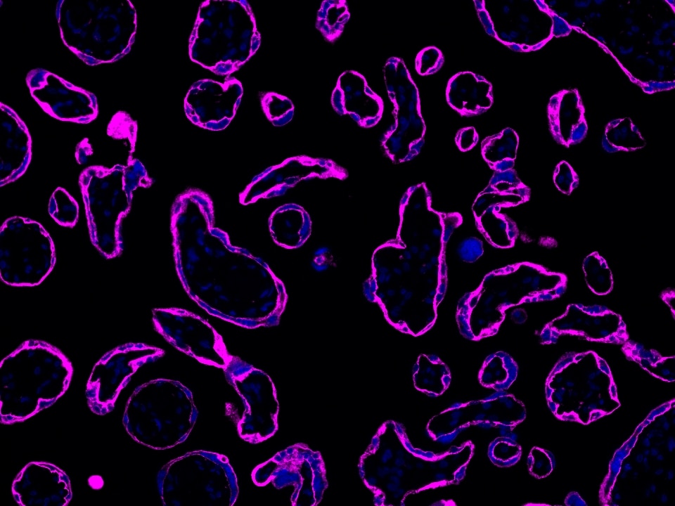 IF Staining using CoraLite®Plus 647-Tyramide Reagent PR30025. 
FFPE-human placenta tissue was stained with 30031-1-AP (SLC43A2 polyclonal antibody) at 1:500 followed by detection of Multi-rAb® Polymer HRP-Goat Anti-Rabbit/Mouse Universal Recombinant Secondary Antibody (H+L) (Cat.NO. RGAU011). CoraLite®Plus 647-Tyramide Reagent (Cat.NO. PR30025) was used for signal development. Cell nucleus (blue) was stained with DAPI.