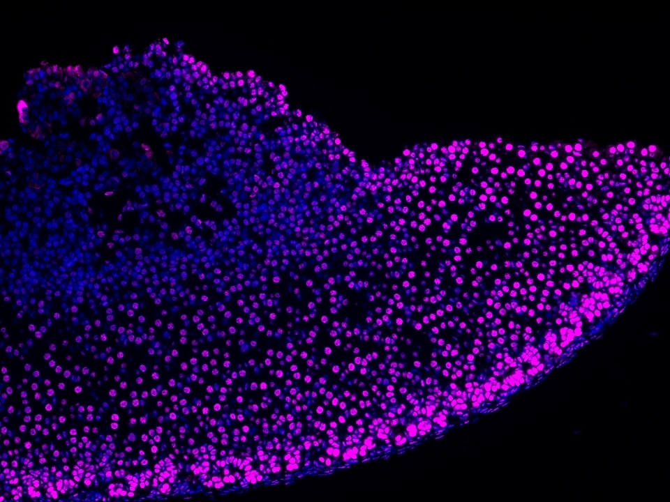 IF Staining using CoraLite®Plus 647-Tyramide Reagent PR30025. 
FFPE-mouse adrenal gland tissue was stained with 82979-6-RR (ARID1B Recombinant antibody) at 1:16000 followed by detection of Multi-rAb® Polymer HRP-Goat Anti-Rabbit/Mouse Universal Recombinant Secondary Antibody (H+L) (Cat.NO. RGAU011). CoraLite®Plus 647-Tyramide Reagent (Cat.NO. PR30025) was used for signal development. Cell nucleus (blue) was stained with DAPI.