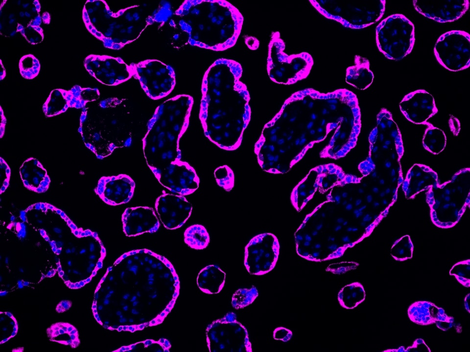 IF Staining using CoraLite®Plus 647-Tyramide Reagent PR30025. 
FFPE-human placenta tissue was stained with 83755-2-RR (RNF139 Recombinant antibody) at 1:2000 followed by detection of Multi-rAb® Polymer HRP-Goat Anti-Rabbit/Mouse Universal Recombinant Secondary Antibody (H+L) (Cat.NO. RGAU011). CoraLite®Plus 647-Tyramide Reagent (Cat.NO. PR30025) was used for signal development. Cell nucleus (blue) was stained with DAPI.