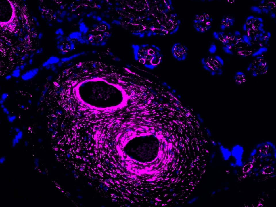 IF Staining using CoraLite®Plus 647-Tyramide Reagent PR30025. 
FFPE-human placenta tissue was stained with 67882-1-Ig (LPCAT3 Monoclonal antibody) at 1:1000 followed by detection of Multi-rAb® Polymer HRP-Goat Anti-Rabbit/Mouse Universal Recombinant Secondary Antibody (H+L) (Cat.NO. RGAU011). CoraLite®Plus 647-Tyramide Reagent (Cat.NO. PR30025) was used for signal development. Cell nucleus (blue) was stained with DAPI.