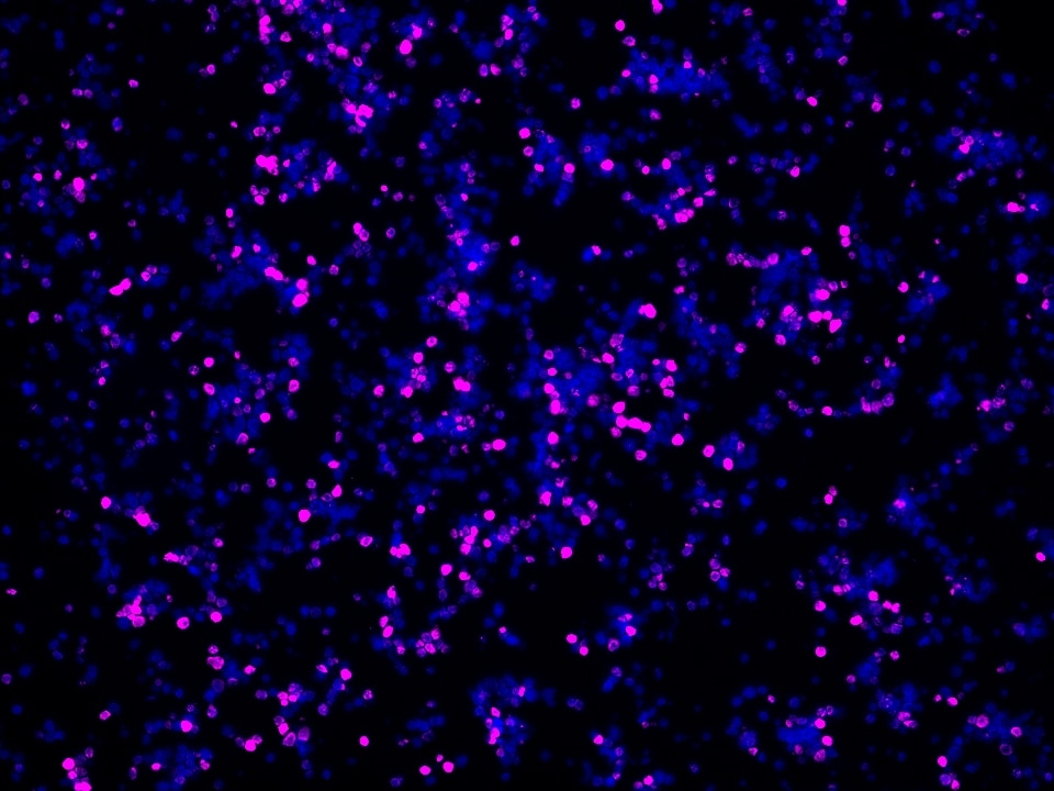 IF Staining using CoraLite®Plus 647-Tyramide Reagent PR30025. 
FFPE-MJ cells was stained with 68803-2-Ig (FOXP3 Monoclonal antibody) at 1:2000 followed by detection of Multi-rAb® Polymer HRP-Goat Anti-Rabbit/Mouse Universal Recombinant Secondary Antibody (H+L) (Cat.NO. RGAU011). CoraLite®Plus 647-Tyramide Reagent (Cat.NO. PR30025) was used for signal development. Cell nucleus (blue) was stained with DAPI.