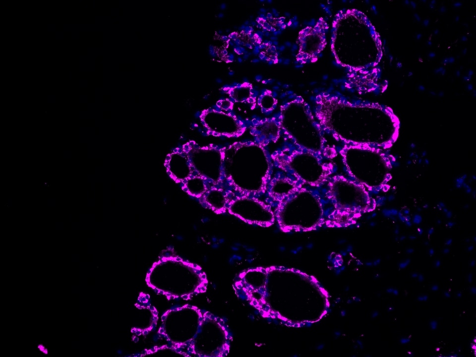 IF Staining using CoraLite®Plus 647-Tyramide Reagent PR30025. 
FFPE-rat thyroid gland tissue was stained with 24368-1-AP (RBM46 polyclonal antibody) at 1:500 followed by detection of Multi-rAb® Polymer HRP-Goat Anti-Rabbit/Mouse Universal Recombinant Secondary Antibody (H+L) (Cat.NO. RGAU011). CoraLite®Plus 647-Tyramide Reagent (Cat.NO. PR30025) was used for signal development. Cell nucleus (blue) was stained with DAPI. 