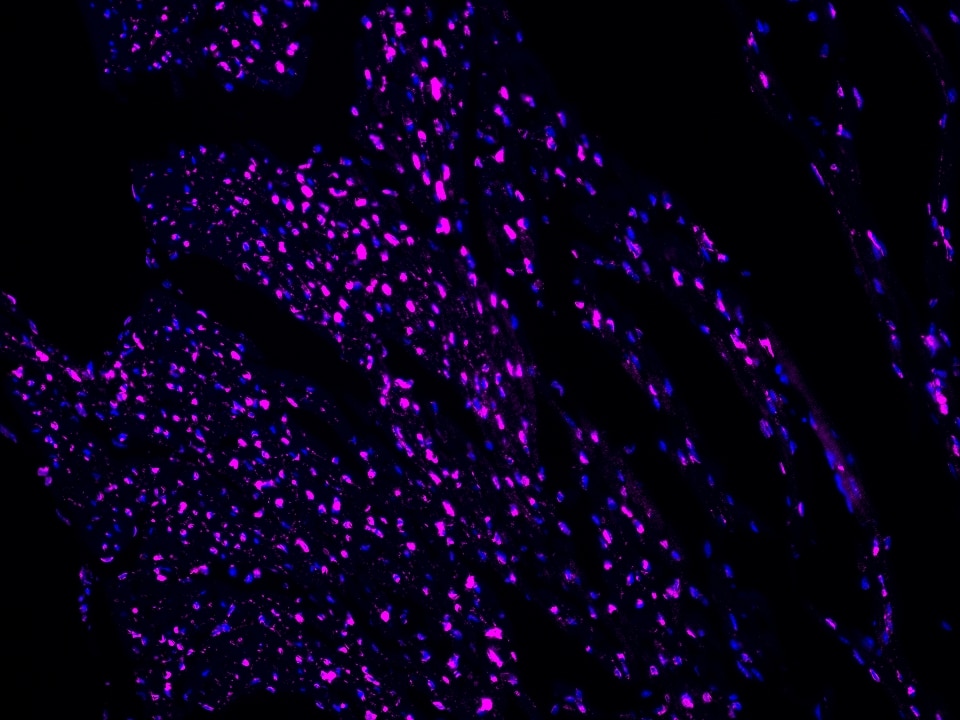 IF Staining using CoraLite®Plus 647-Tyramide Reagent PR30025. 
FFPE-mouse heart tissue was stained with 82962-1-RR (SNIP1 Recombinant antibody) at 1:500 followed by detection of Multi-rAb® Polymer HRP-Goat Anti-Rabbit/Mouse Universal Recombinant Secondary Antibody (H+L) (Cat.NO. RGAU011). CoraLite®Plus 647-Tyramide Reagent (Cat.NO. PR30025) was used for signal development. Cell nucleus (blue) was stained with DAPI.