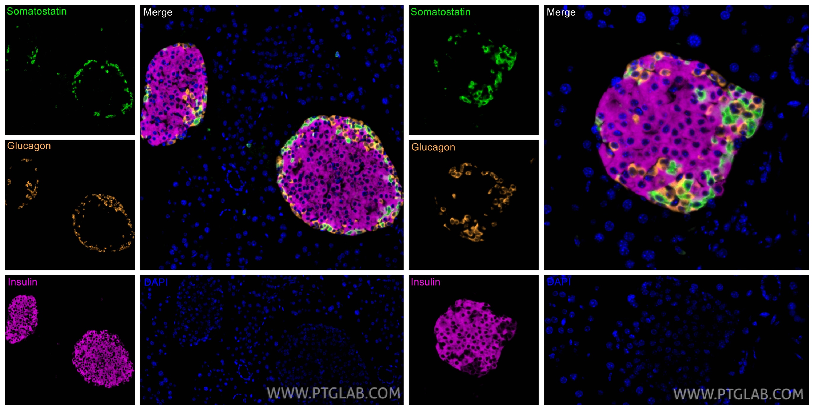 Immunofluorescent analysis of (4% PFA) fixed paraffin-embedded mouse pancreas tissue using Somatostatin antibody 17512-1-AP at dilution of 1:200 with CoraLite®Plus 488-Tyramide reagent(green), INS antibody 15848-1-AP at dilution of 1:200 with CoraLite®Plus 647-Tyramide reagent(magenta), Glucagon antibody 15954-1-AP with CoraLite®Plus 555-Tyramide reagent(orange). Heat mediated antigen retrieval with Tris-EDTA buffer (pH 9.0). Immunofluorescent analysis of (4% PFA) fixed paraffin-embedded mouse pancreas tissue using Somatostatin antibody 17512-1-AP at dilution of 1:200 with CoraLite®Plus 488-Tyramide reagent(green), INS antibody 15848-1-AP at dilution of 1:200 with CoraLite®Plus 647-Tyramide reagent(magenta), Glucagon antibody 15954-1-AP with CoraLite®Plus 555-Tyramide reagent(orange). Heat mediated antigen retrieval with Tris-EDTA buffer (pH 9.0).
