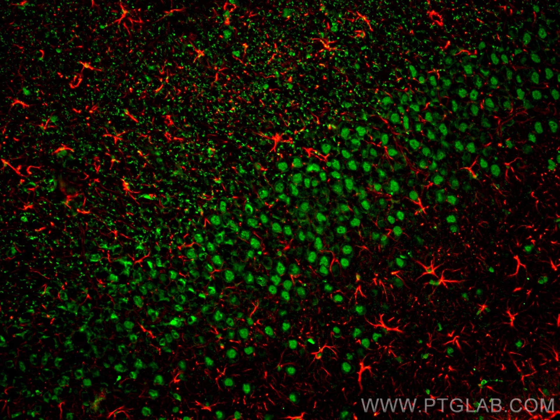 Immunofluorescence of rat brain: rat brain FFPE section was stained with Rabbit anti-GFAP polyclonal antibody (16825-1-AP, 1:200, red) and mouse anti-NeuN monoclonal antibody (66836-1-Ig, green). Multi-rAb CoraLite® Plus 594 conjugated Recombinant Goat anti-rabbit secondary antibody (RGAR004, 1:500) and Multi-rAb CoraLite® Plus 488 conjugated Goat Anti-Mouse Recombinant Secondary Antibody (H+L) were used for detection (RGAM002, 1:500) .