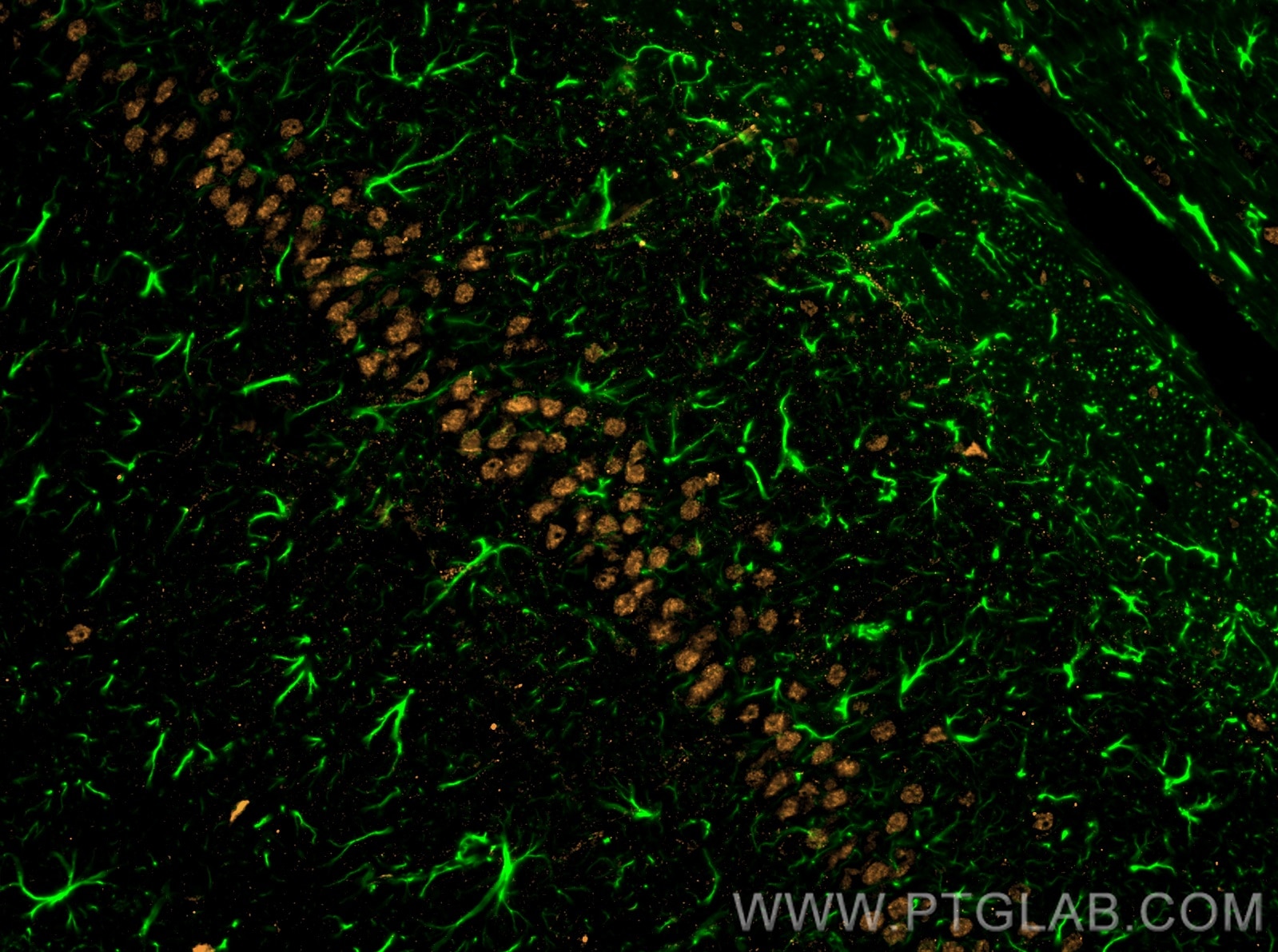 Immunofluorescence of rat brain: rat brain FFPE section was stained with Rabbit anti-GFAP polyclonal antibody (16825-1-AP, 1:200, green) and mouse anti-NeuN monoclonal antibody (66836-1-Ig, orange). Multi-rAb™ CoraLite® Plus 488 conjugated Recombinant Goat anti-rabbit secondary antibody (RGAR002, 1:500) and Multi-rAb™ CoraLite® Plus 555 conjugated Goat Anti-Mouse Recombinant Secondary Antibody (H+L) were used for detection (RGAM003, 1:500) . 