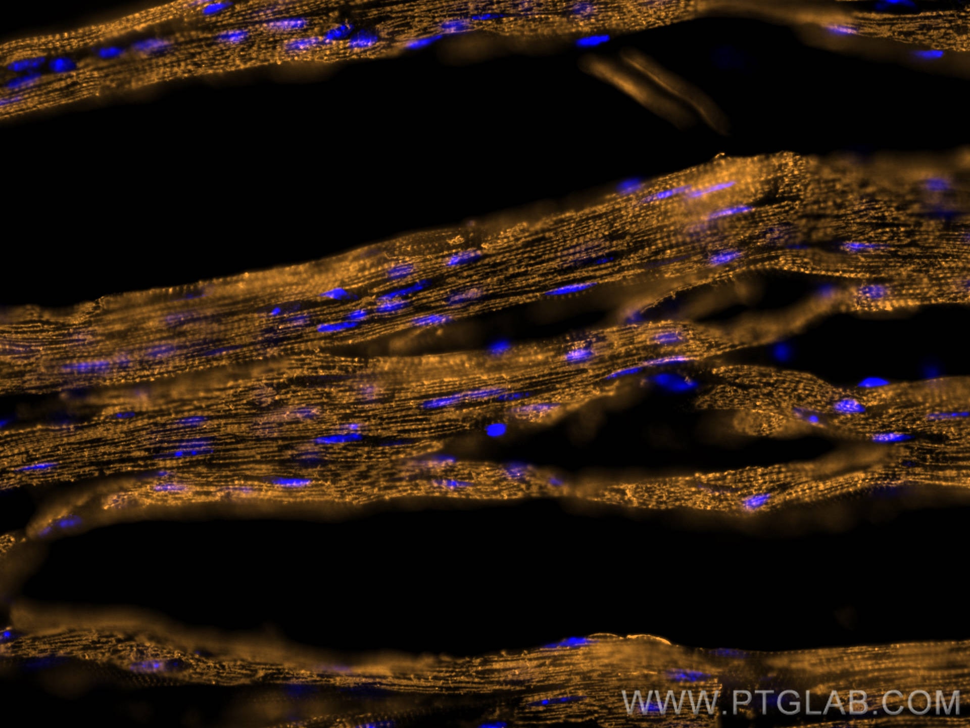 Immunofluorescent analysis of (4% PFA) fixed OCT-embedded frozen mouse heart tissue using ACTC1-specific antibody (66125-1-Ig, Clone: 1F2B9 ) at dilution of 1:800 and Multi-rAb CoraLite ® Plus 555-Goat Anti-Mouse Recombinant Secondary Antibody (H+L) (RGAM003).