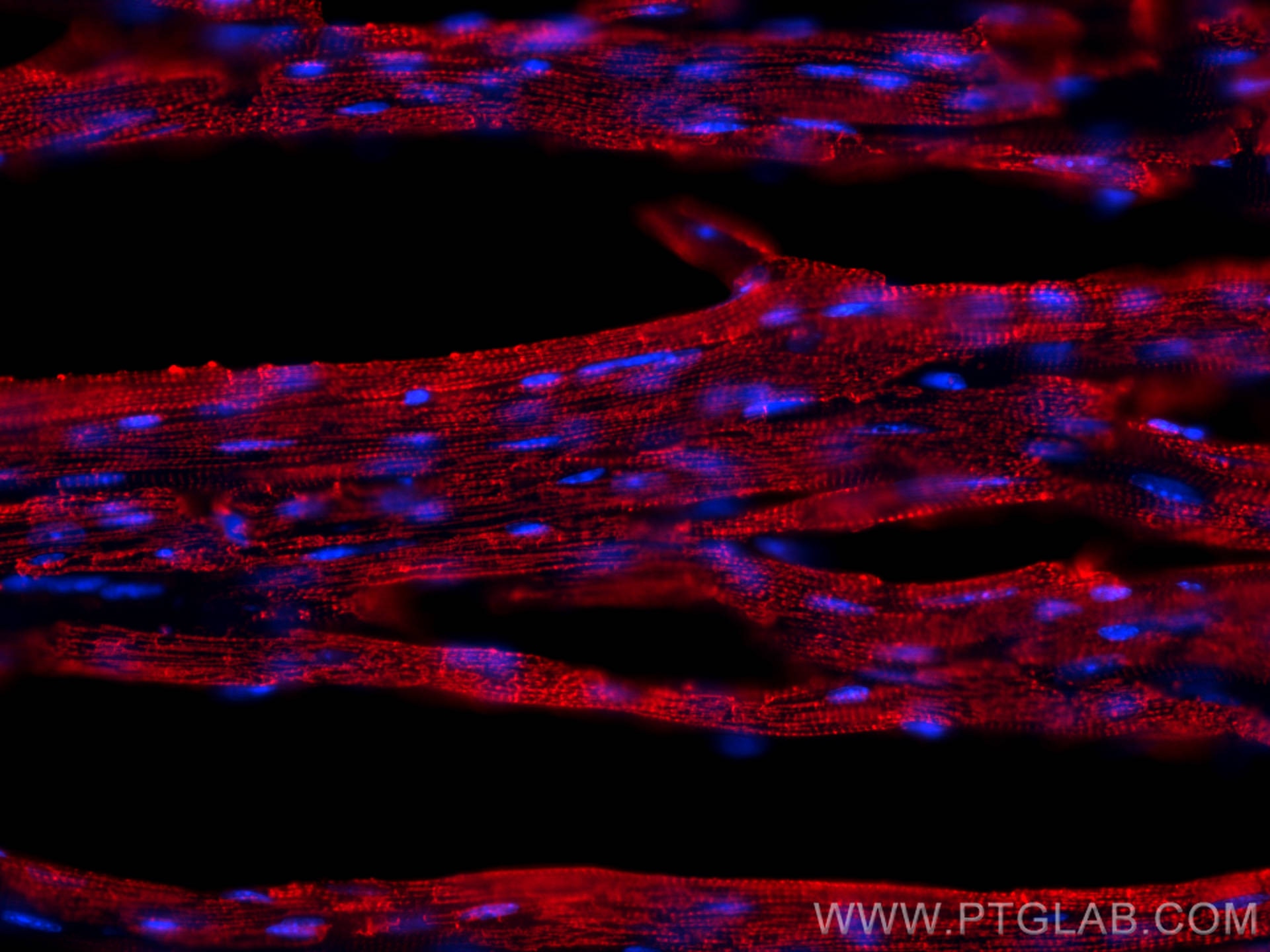 Immunofluorescent analysis of (4% PFA) fixed OCT-embedded frozen mouse heart tissue using ACTC1-specific antibody (66125-1-Ig, Clone: 1F2B9 ) at dilution of 1:800 and Multi-rAb CoraLite ® Plus 594-Goat Anti-Mouse Recombinant Secondary Antibody (H+L) (RGAM004).