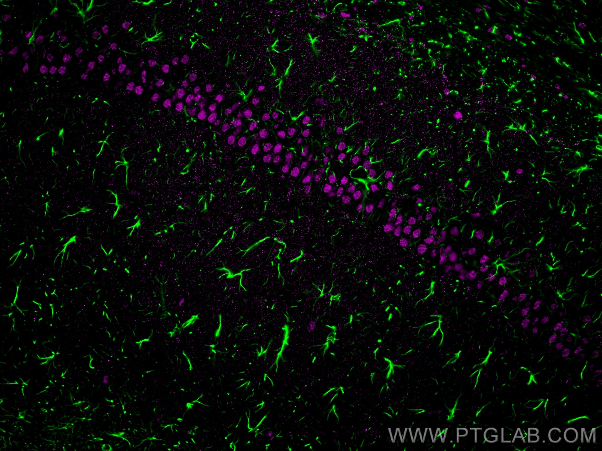 Immunofluorescence of rat brain: rat brain FFPE section was stained with Rabbit anti-GFAP polyclonal antibody (16825-1-AP, 1:200, green) and mouse anti-NeuN monoclonal antibody (66836-1-Ig, magenta). Multi-rAb CoraLite® Plus 488 conjugated Recombinant Goat anti-rabbit secondary antibody (RGAR002, 1:500) and Multi-rAb CoraLite® Plus 647 conjugated Goat Anti-Mouse Recombinant Secondary Antibody (H+L) were used for detection (RGAM005, 1:500) . 