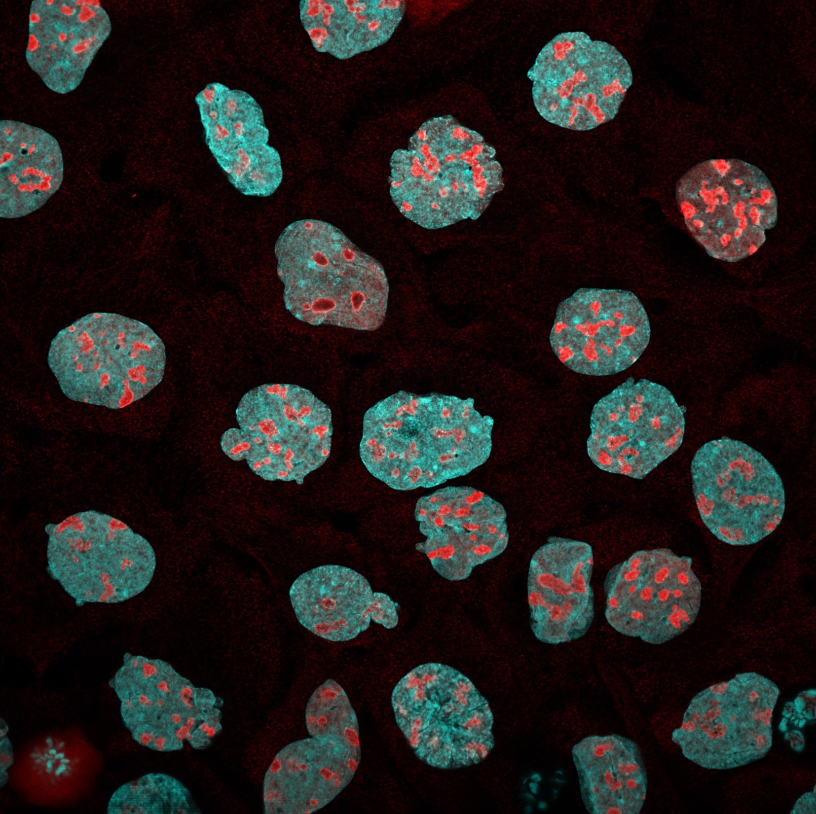 Immunofluorescence of A431 cells: PFA-fixed cells were stained with anti-B23 (60096-1-Ig), followed by Multi-rAb CoraLite® Plus 750-Goat Anti-Mouse Recombinant Secondary Antibody (H+L) (RGAM006, 1:500, red), nuclei stained with DAPI (cyan). Confocal images were acquired with a 63x oil objective and post-processed. Images were recorded at the Core Facility Bioimaging at the Biomedical Center, LMU Munich.  Device setting for target: Laser Ex max 764nm, filter Em max 775nm.