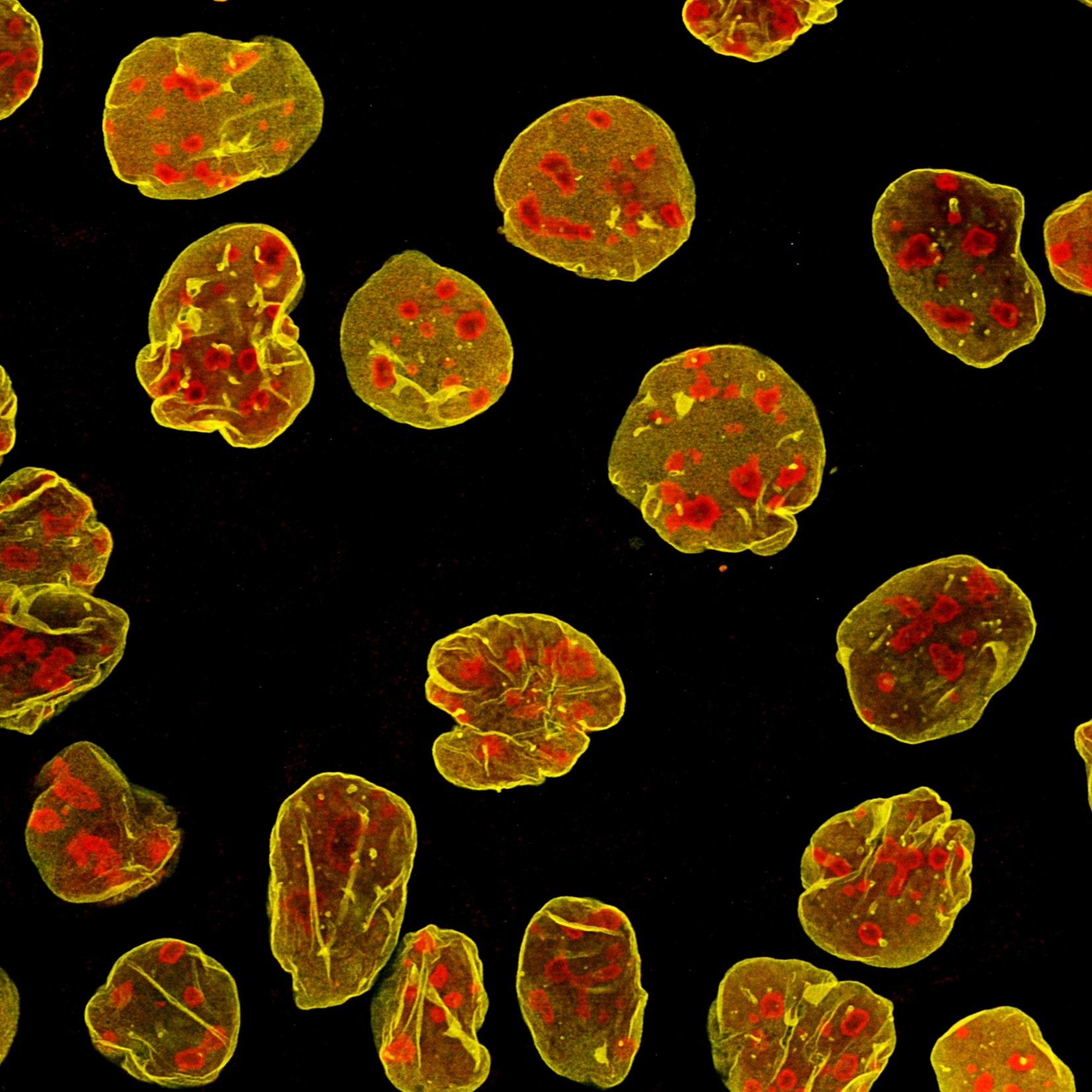 Immunofluorescence of A431 cells: PFA-fixed cells were co-stained with mouse anti-B23 (60096-1-Ig) and rabbit anti-Lamin B1 (12987-1-AP), followed by Multi-rAb CoraLite® Plus 750-Goat Anti-Mouse Recombinant Secondary Antibody (H+L) (RGAM006, 1:500, red) and Nano-Secondary srb2GCL555-1 (yellow). Confocal images were acquired with a 63x oil objective and post-processed. Images were recorded at the Core Facility Bioimaging at the Biomedical Center, LMU Munich. Device setting for RGAM006: Laser Ex max 764nm, filter Em max 775nm.