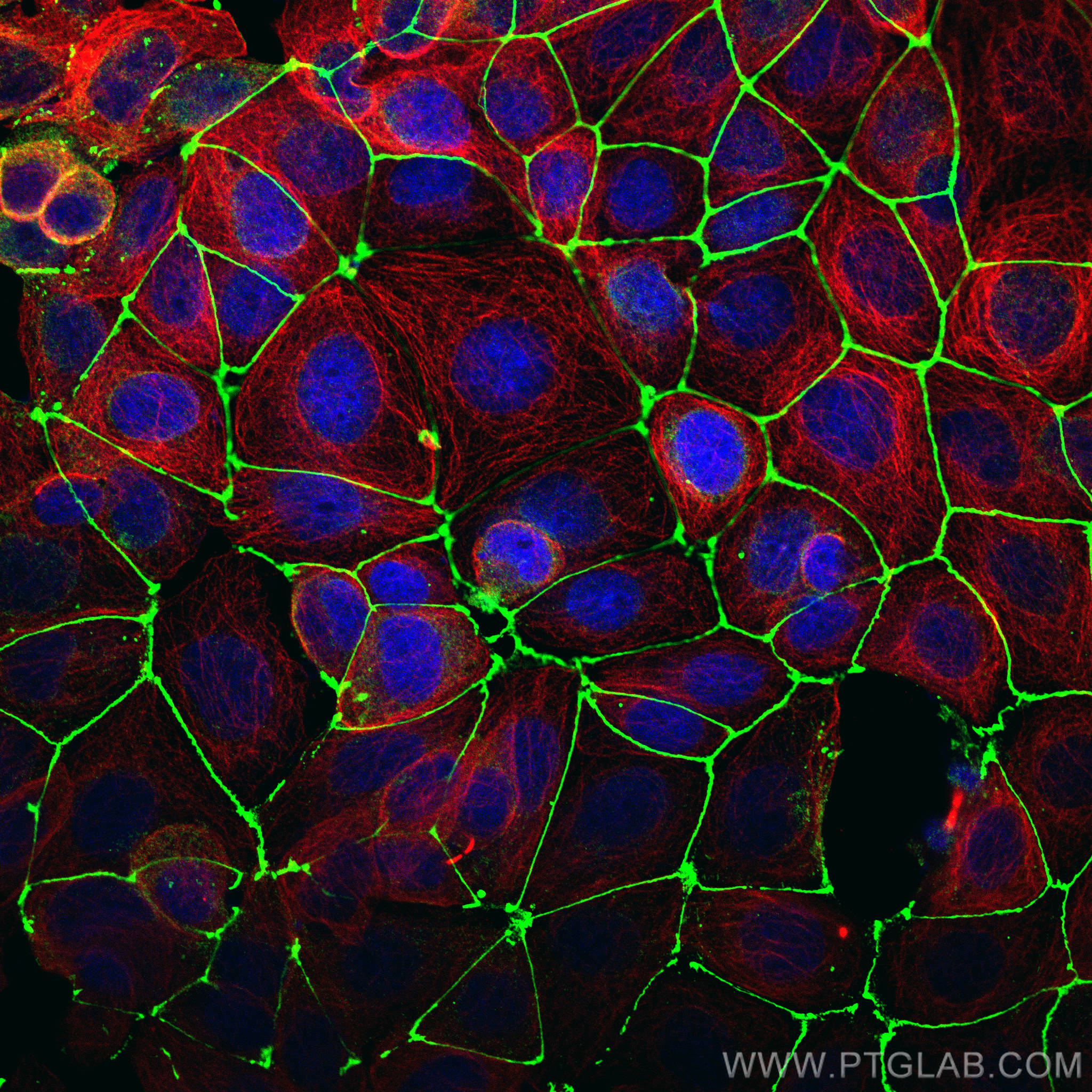 Immunofluorescence of MCF-7 cells: MCF-7 cells were fixed with 4% PFA and stained with Rabbit anti-ZO1 polyclonal antibody (21773-1-AP, 1:2000, green) and mouse anti-Alpha Tubulin monoclonal antibody (66031-1-Ig, 1:1000, red). Multi-rAb CoraLite® Plus 488-Goat Anti-Rabbit Recombinant Secondary Antibody (H+L) (RGAR002, 1:500) and Multi-rAb CoraLite® Plus 594-Goat Anti-Mouse Recombinant Secondary Antibody (H+L) (RGAM004, 1:500) were used for detection.