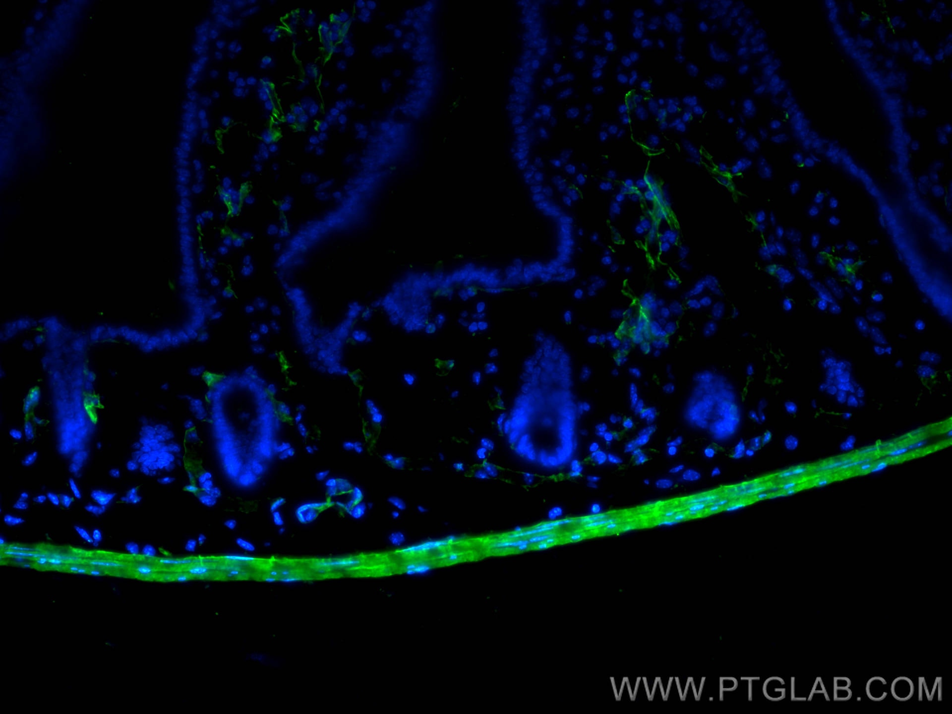 Immunofluorescent analysis of (4% PFA) fixed OCT-embedded frozen mouse small intestine tissue using smooth muscle actin antibody (14395-1-AP) at dilution of 1:400 and Multi-rAb CoraLite ® Plus 488-Goat Anti-Rabbit Recombinant Secondary Antibody (H+L) (RGAR002).