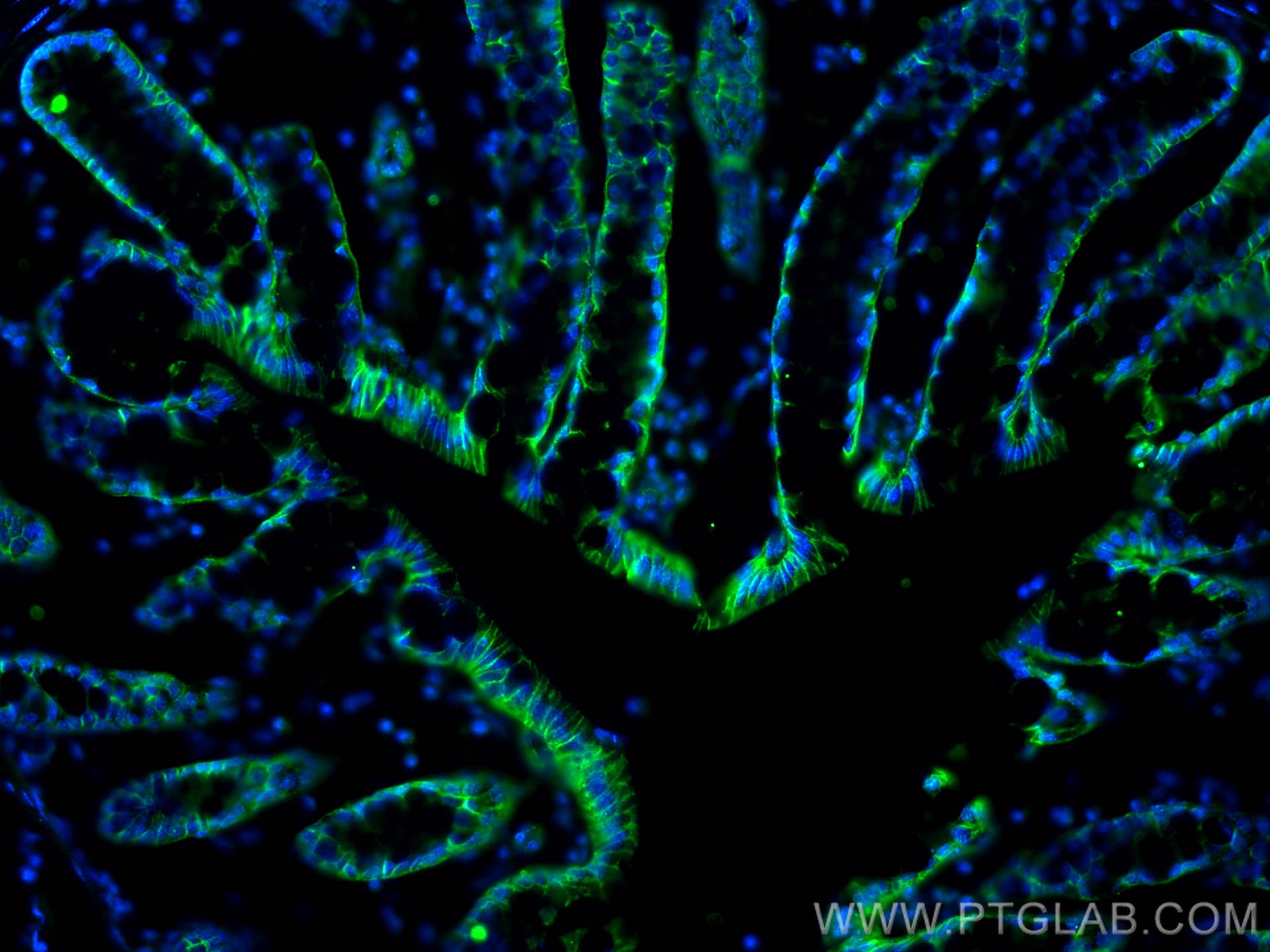 Immunofluorescent analysis of (4% PFA) fixed OCT-embedded frozen mouse colon tissue using E-cadherin antibody (20874-1-AP) at dilution of 1:400 and Multi-rAb CoraLite ® Plus 488-Goat Anti-Rabbit Recombinant Secondary Antibody (H+L) (RGAR002).