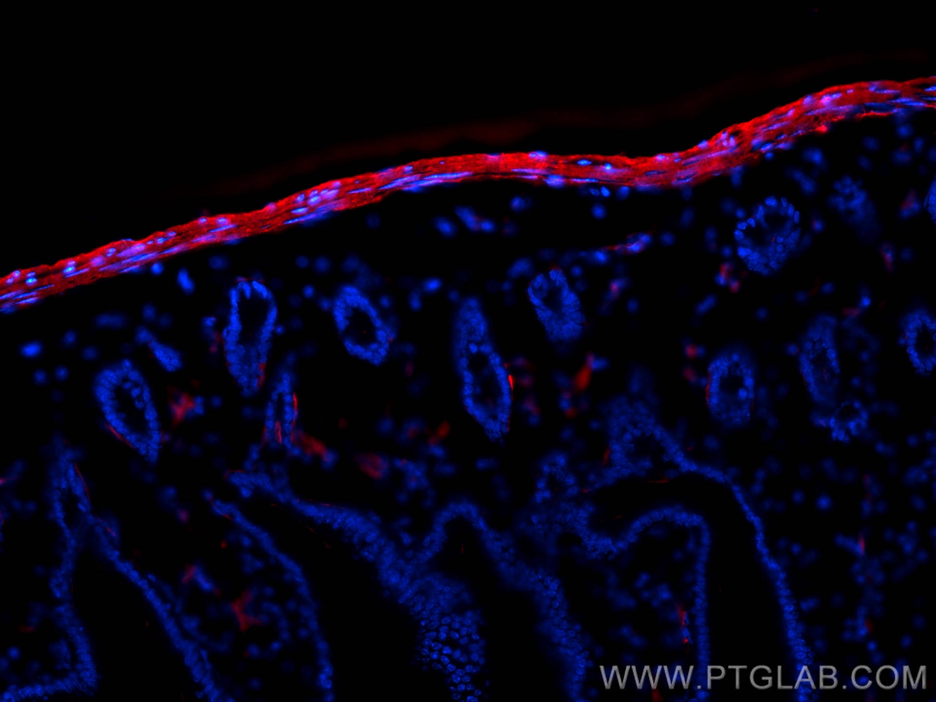 Immunofluorescent analysis of (4% PFA) fixed OCT-embedded frozen mouse small intestine tissue using smooth muscle actin antibody (14395-1-AP) at dilution of 1:400 and Multi-rAb CoraLite ® Plus 594-Goat Anti-Rabbit Recombinant Secondary Antibody (H+L) (RGAR004).