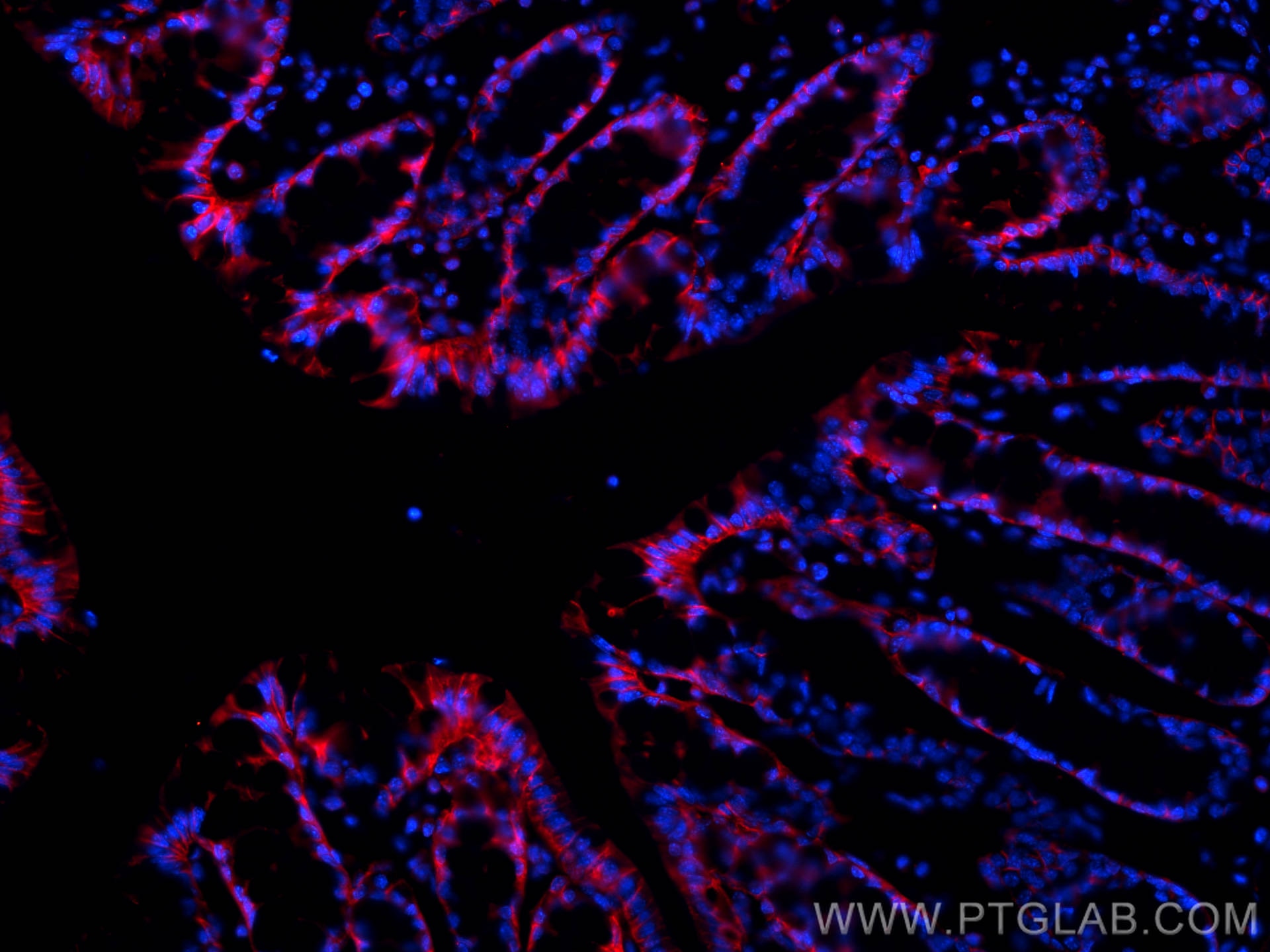 Immunofluorescent analysis of (4% PFA) fixed OCT-embedded frozen mouse colon tissue using E-cadherin antibody (20874-1-AP) at dilution of 1:400 and Multi-rAb CoraLite ® Plus 594-Goat Anti-Rabbit Recombinant Secondary Antibody (H+L) (RGAR004).