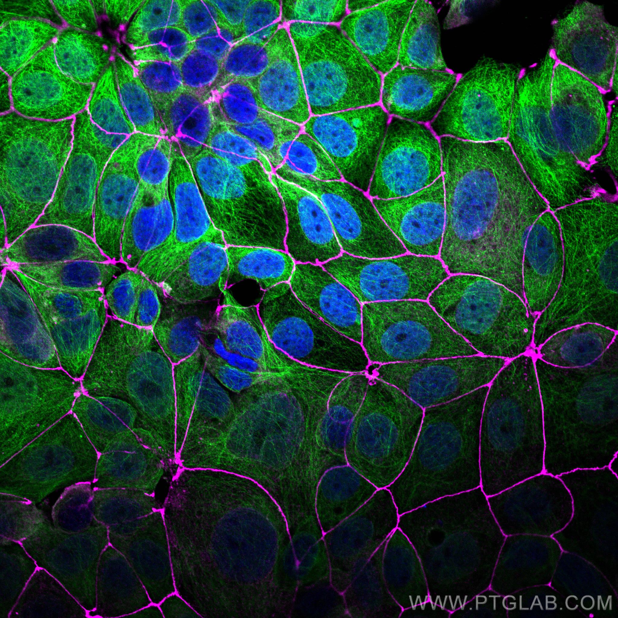 Immunofluorescence of MCF-7 cells: MCF-7 cells were fixed with 4% PFA and stained with Rabbit anti-ZO1 polyclonal antibody (21773-1-AP, 1:2000, magenta) and mouse anti-Alpha Tubulin monoclonal antibody (66031-1-Ig, 1:1000, green). Multi-rAb CoraLite® Plus 647-Goat Anti-Rabbit Recombinant Secondary Antibody (H+L) (RGAR005, 1:500) and Multi-rAb CoraLite® Plus 488-Goat Anti-Mouse Recombinant Secondary Antibody (H+L) (RGAM002, 1:500) were used for detection.