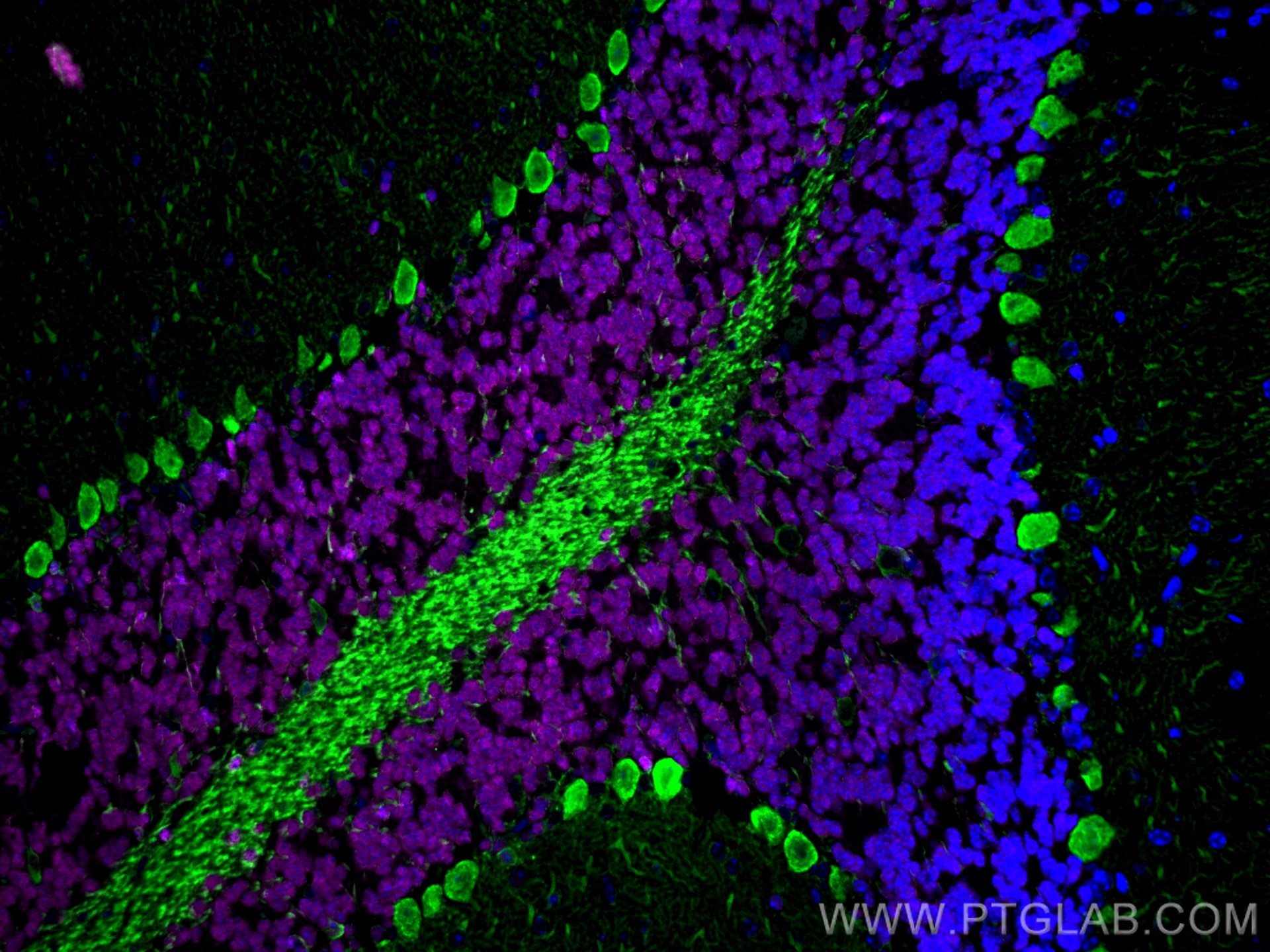 Immunofluorescence of mouse cerebellum: mouse cerebellum FFPE section was stained with Rabbit anti-NeuN polyclonal antibody (26975-1-AP, 1:200, magenta) and mouse anti-Calbindin-D28k monoclonal antibody (66394-1-Ig, 1:200, green). Multi-rAb™ CoraLite® Plus 647 conjugated Recombinant Goat anti-rabbit secondary antibody (RGAR005, 1:500) and Multi-rAb™ CoraLite® Plus 488 conjugated Goat Anti-Mouse Recombinant Secondary Antibody (H+L) were used for detection (RGAM002, 1:500) . 
